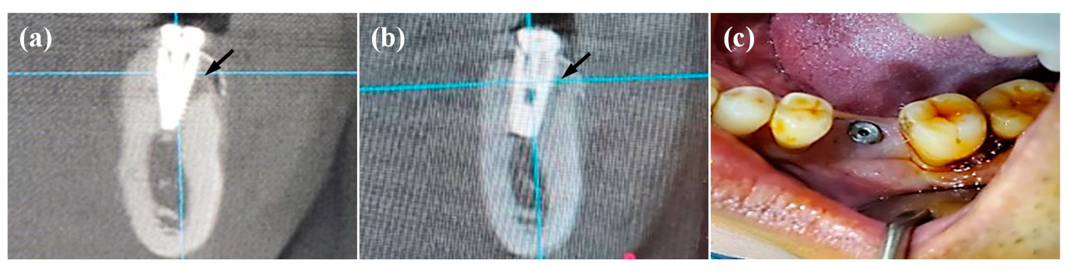 Applsci 10 08582 g006