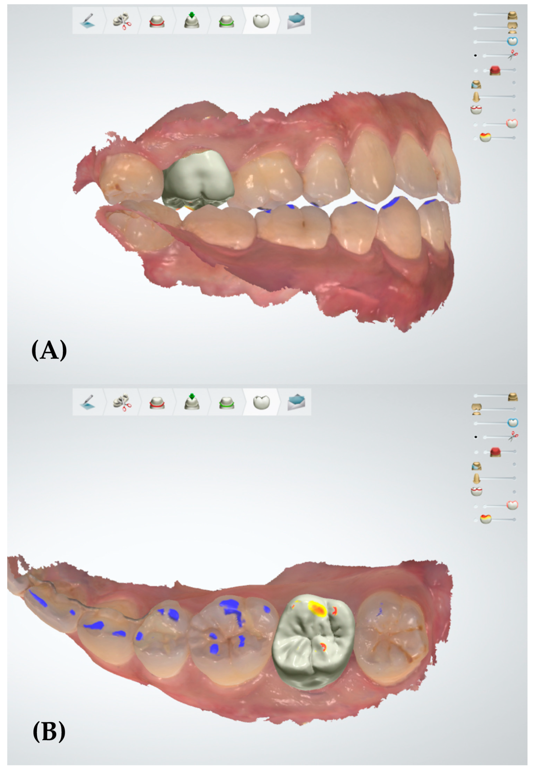 Applsci 10 09140 g003
