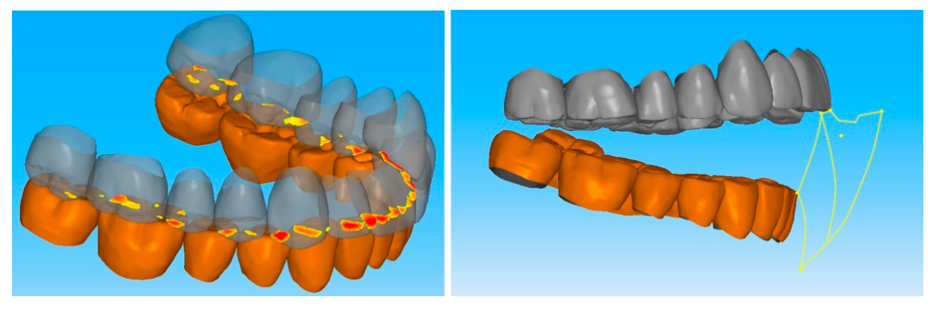 Applsci 11 00060 g003
