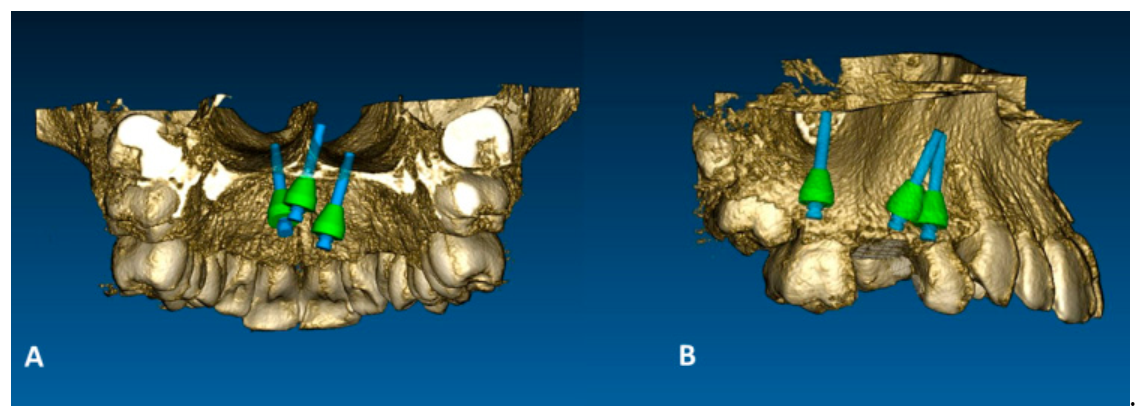 Applsci 11 00928 g005 Applsci 11 00928 g005