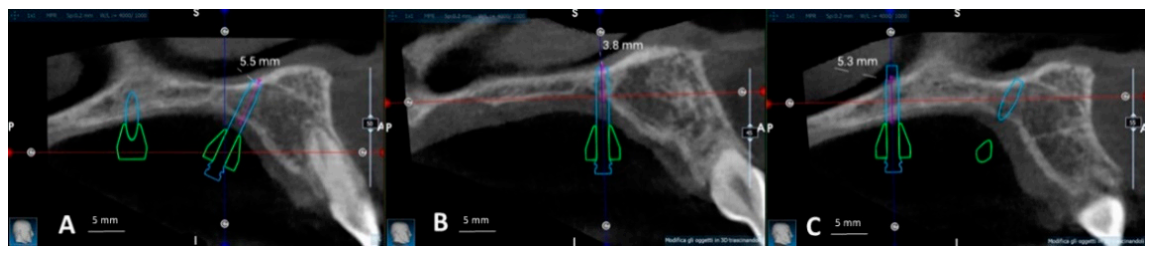 Applsci 11 00928 g006 Applsci 11 00928 g006
