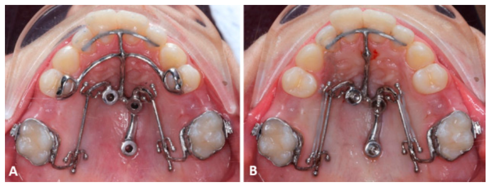 Applsci 11 00928 g007 Applsci 11 00928 g007