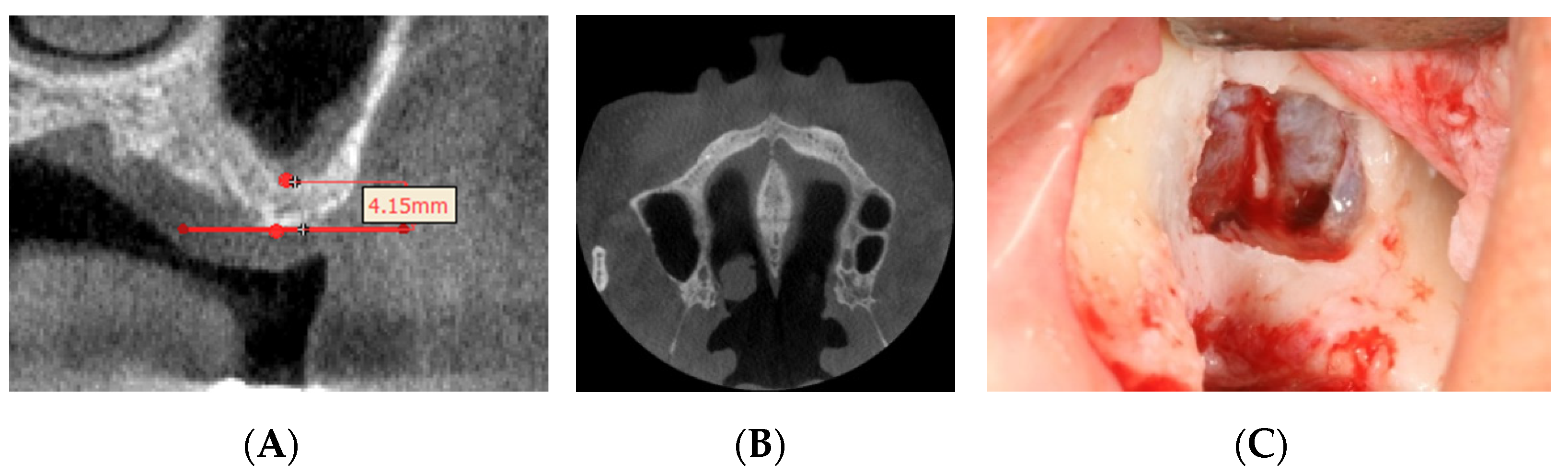 Applsci 11 00951 g004