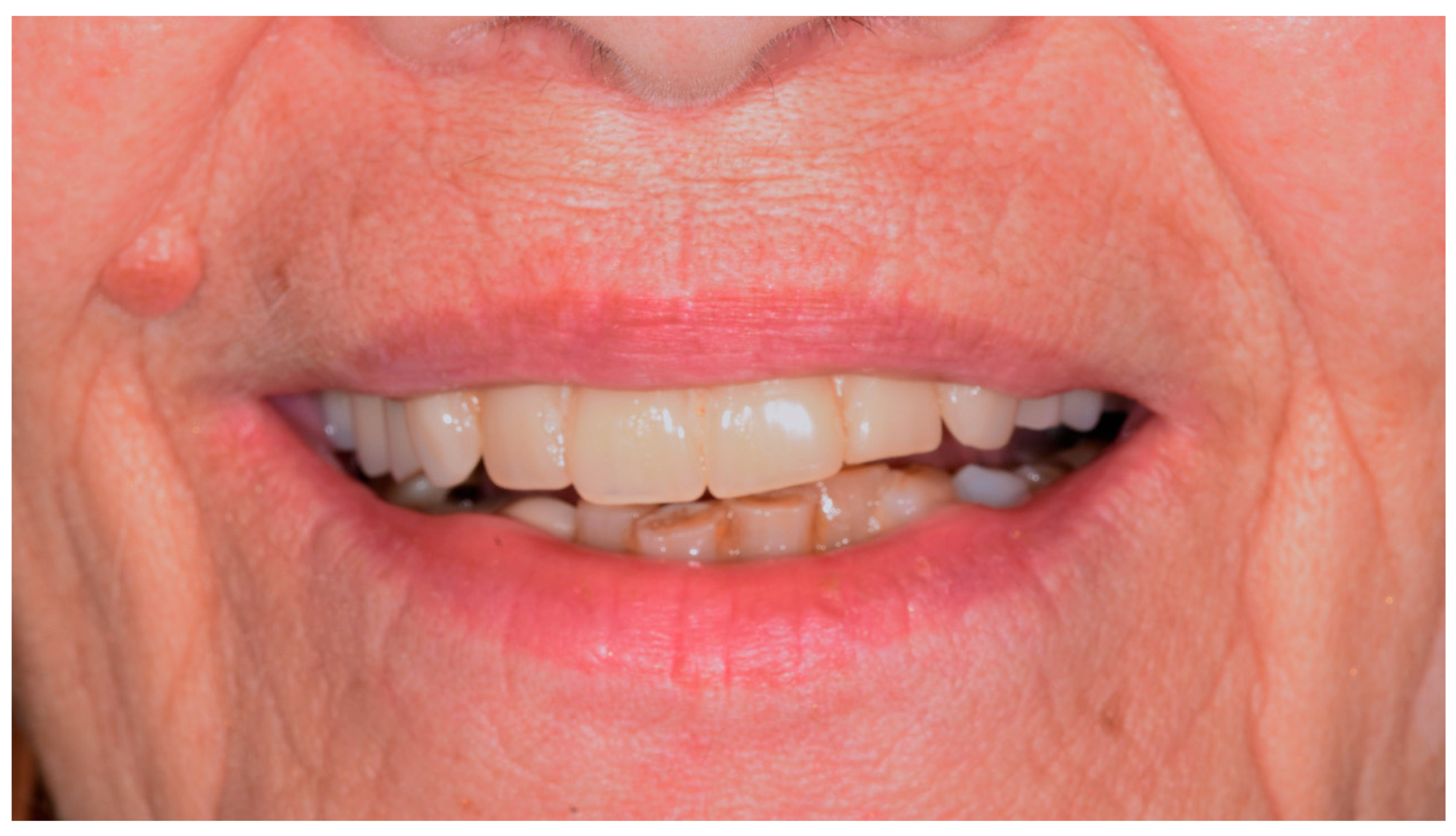 Applsci 11 01122 g001