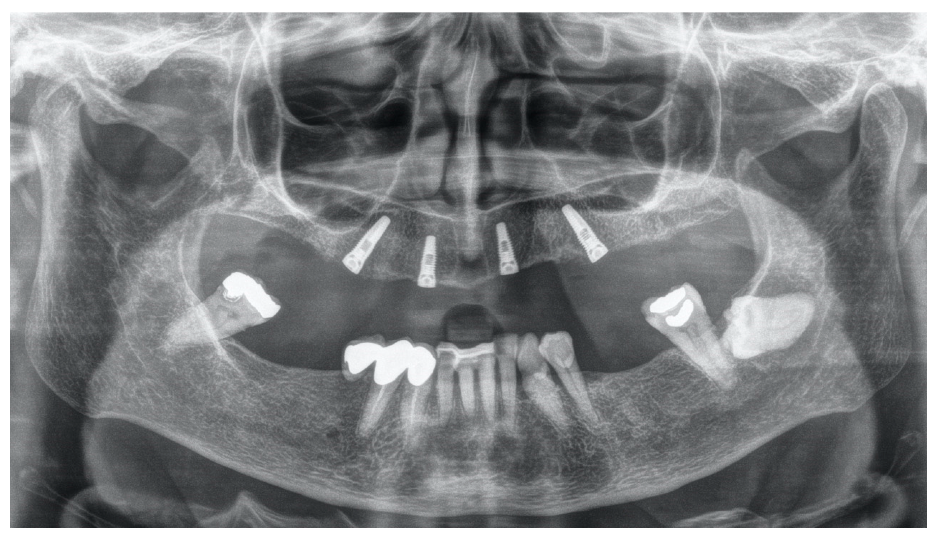 Applsci 11 01122 g002