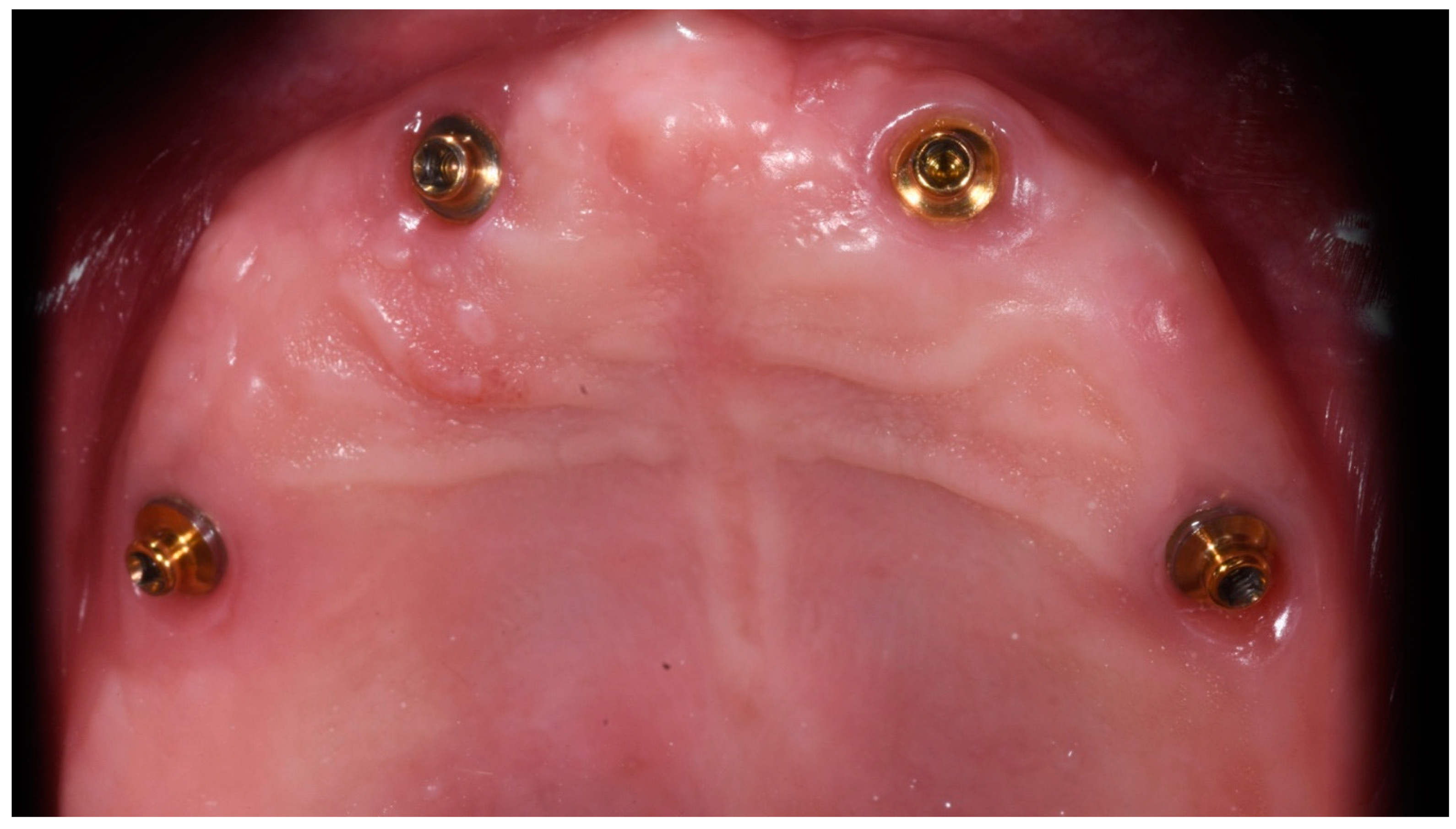 Applsci 11 01122 g004