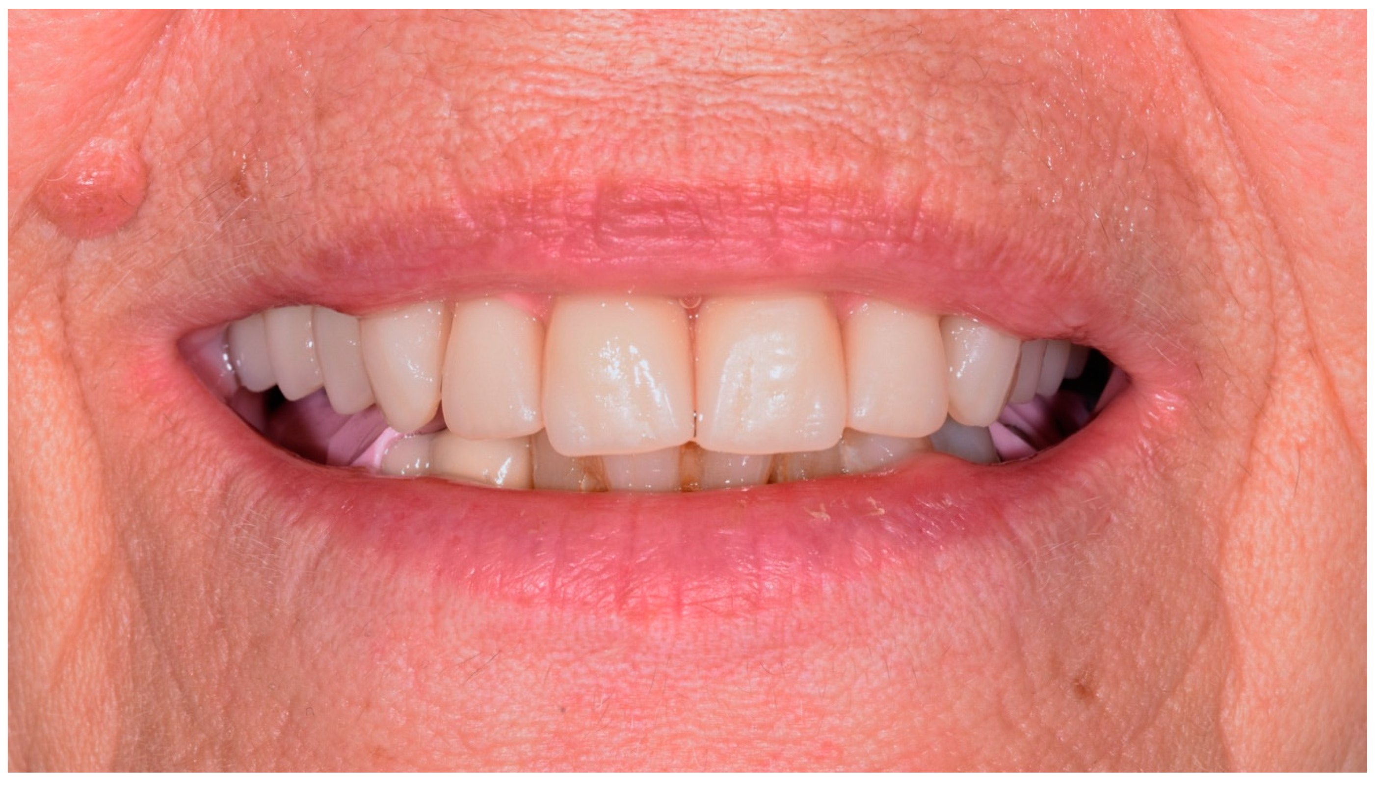 Applsci 11 01122 g020