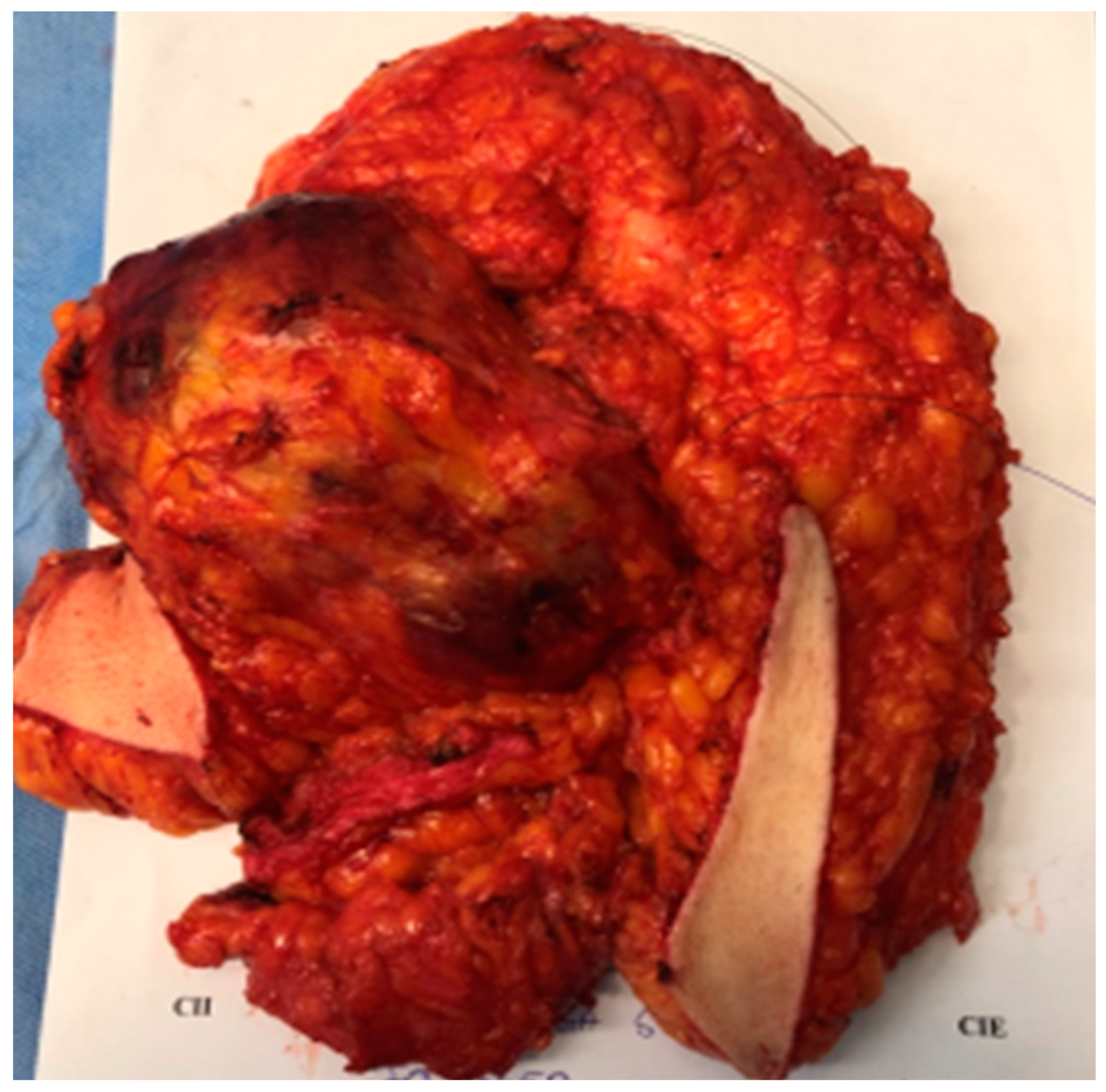 Applsci 11 01224 g004