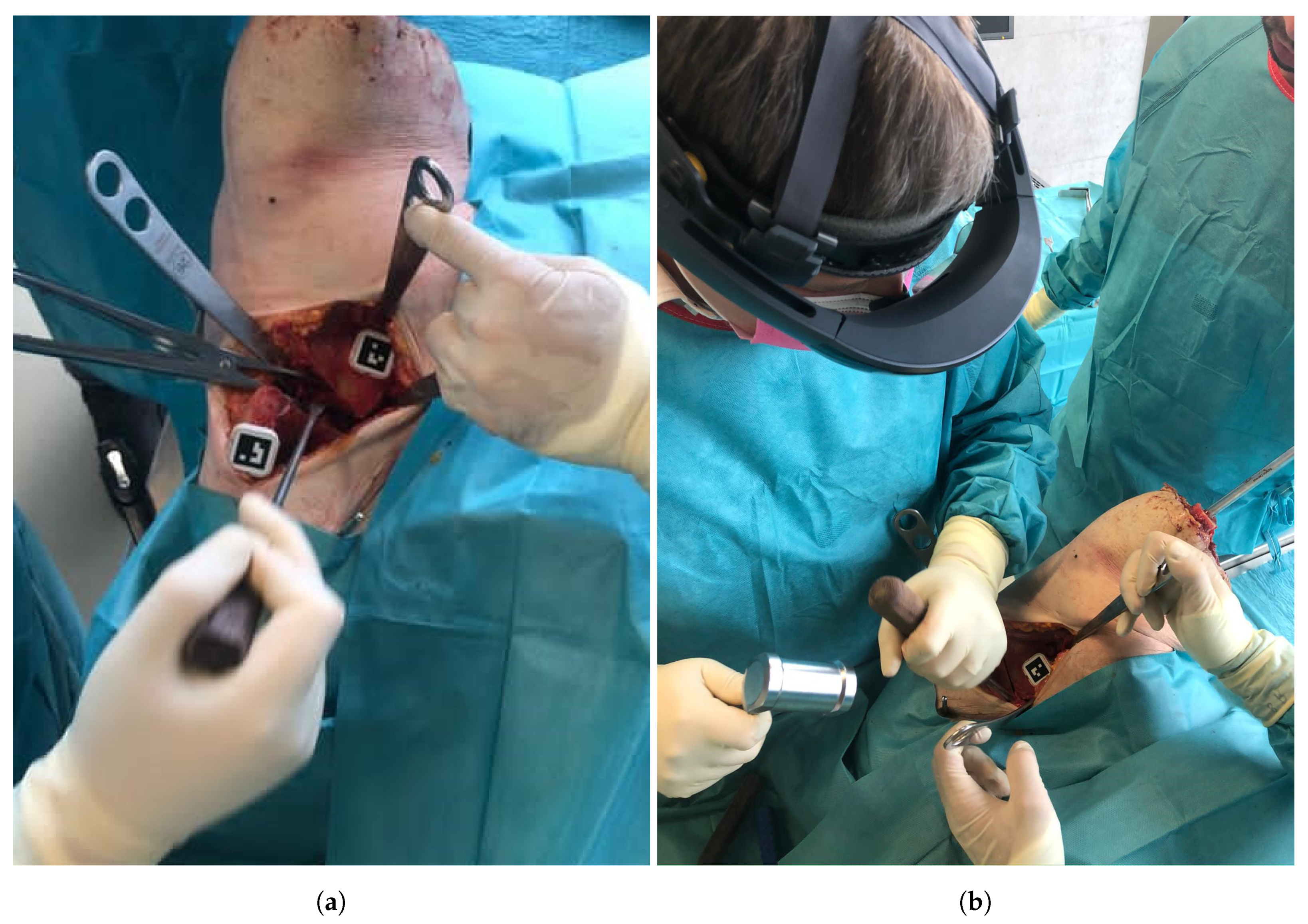 Applsci 11 01228 g004 Applsci 11 01228 g004