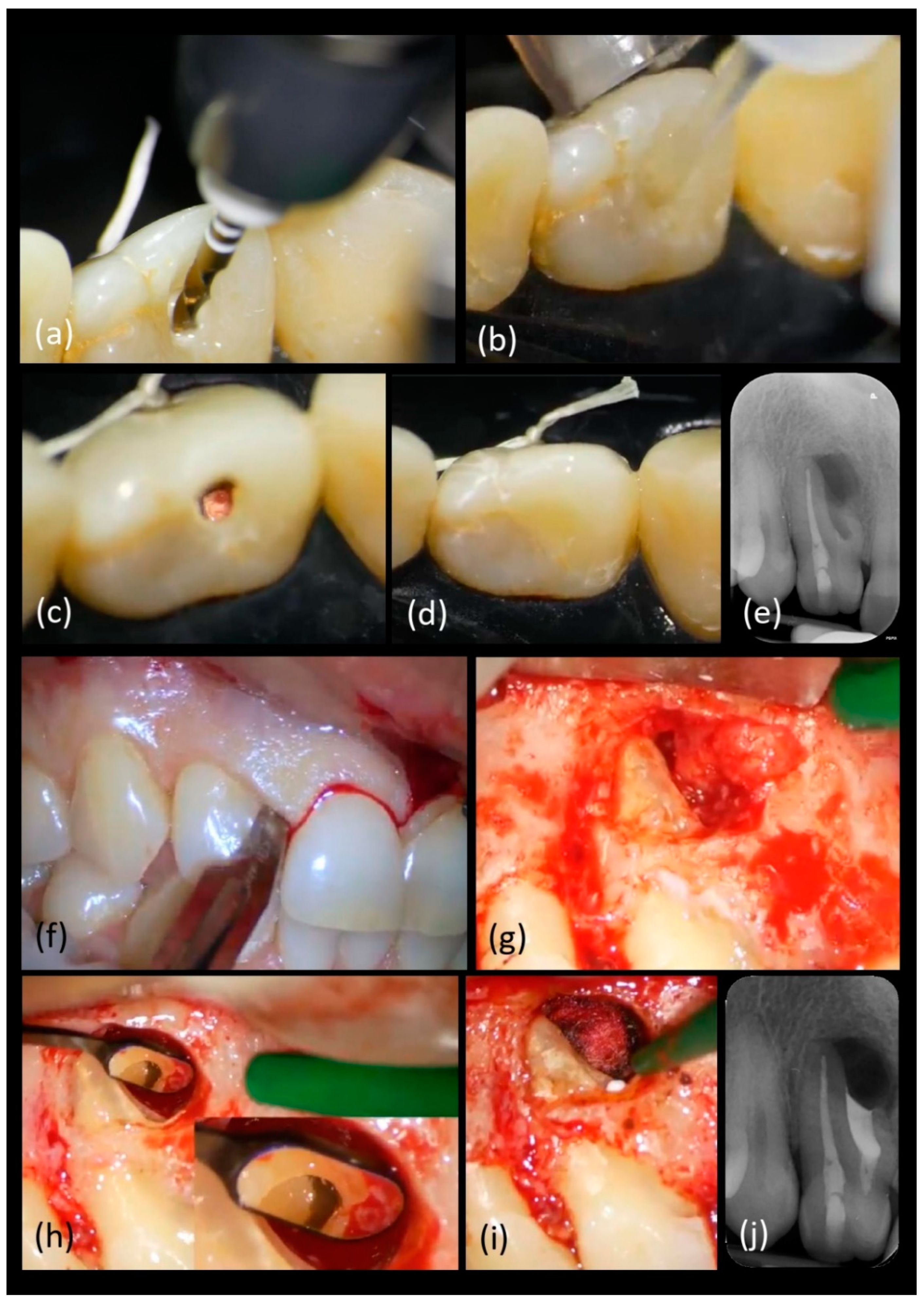 Applsci 11 01511 g004