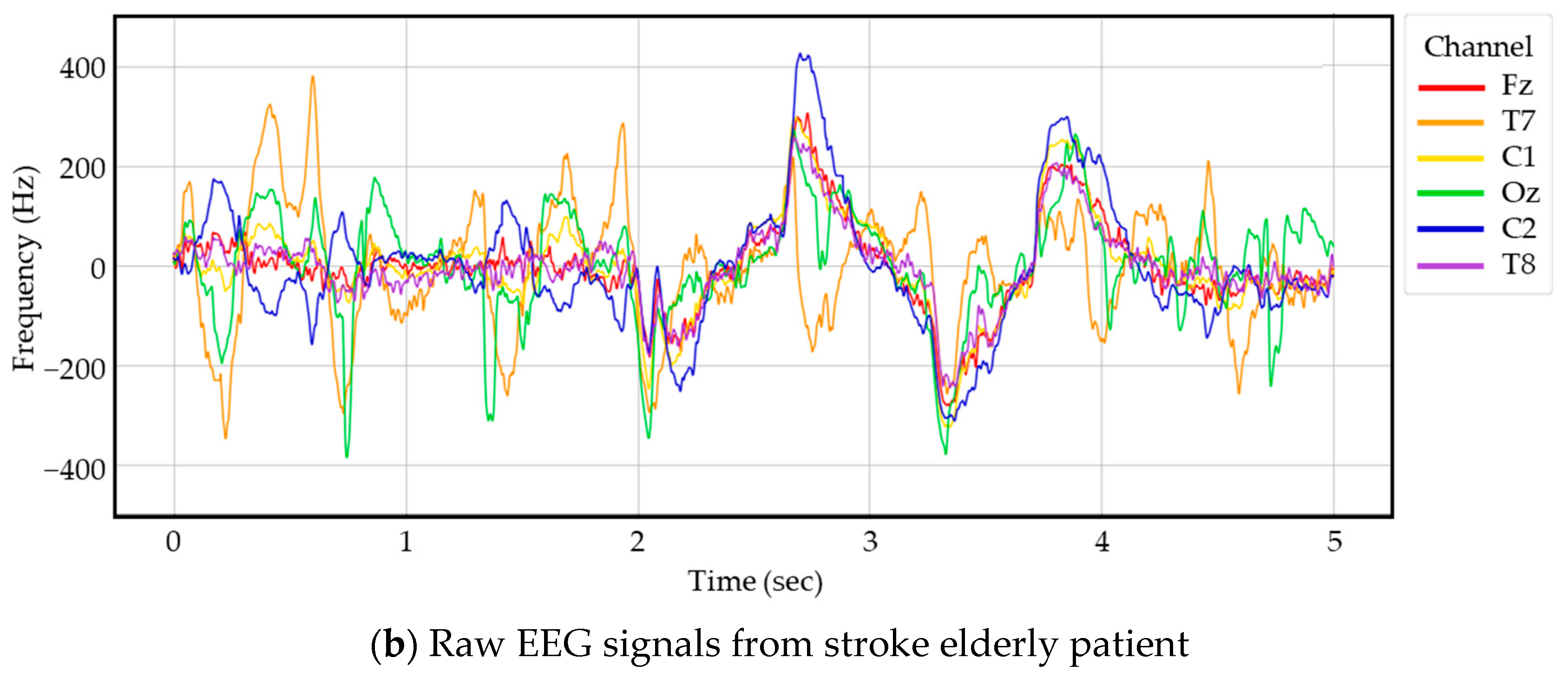 Applsci 11 01761 g003b