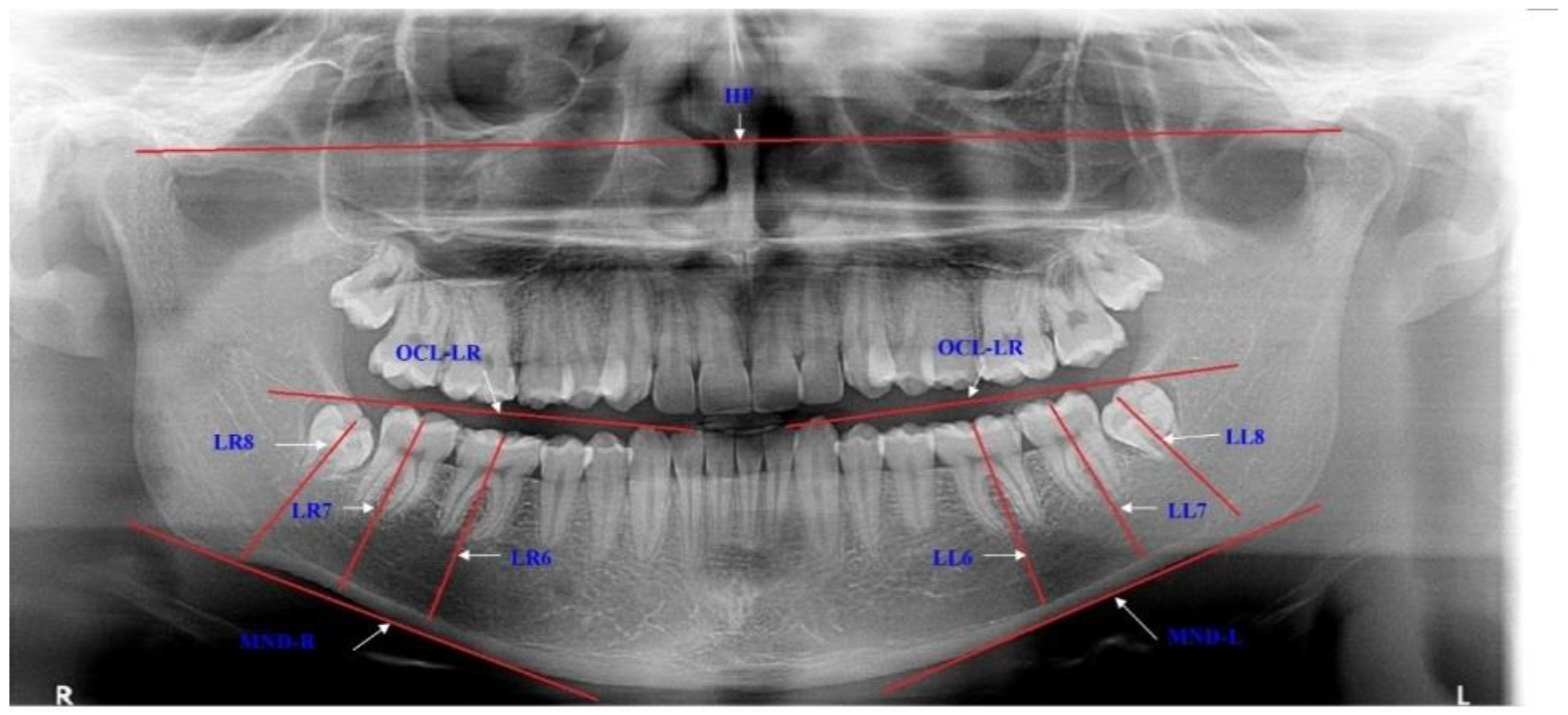 Applsci 11 01824 g001 Applsci 11 01824 g001