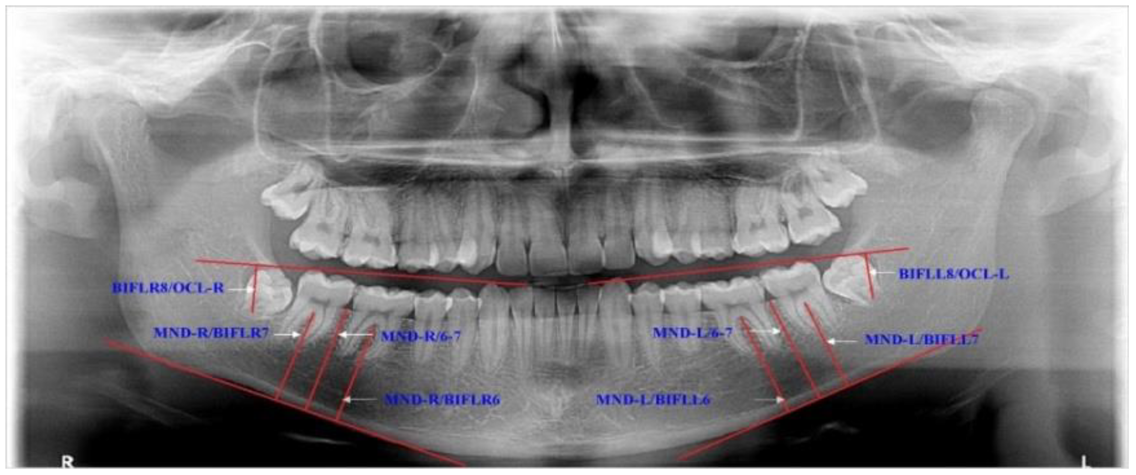 Applsci 11 01824 g002 Applsci 11 01824 g002