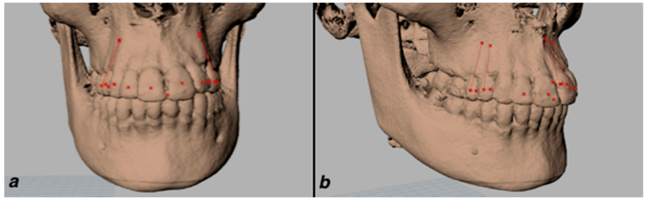 Applsci 11 02374 g002 Applsci 11 02374 g002