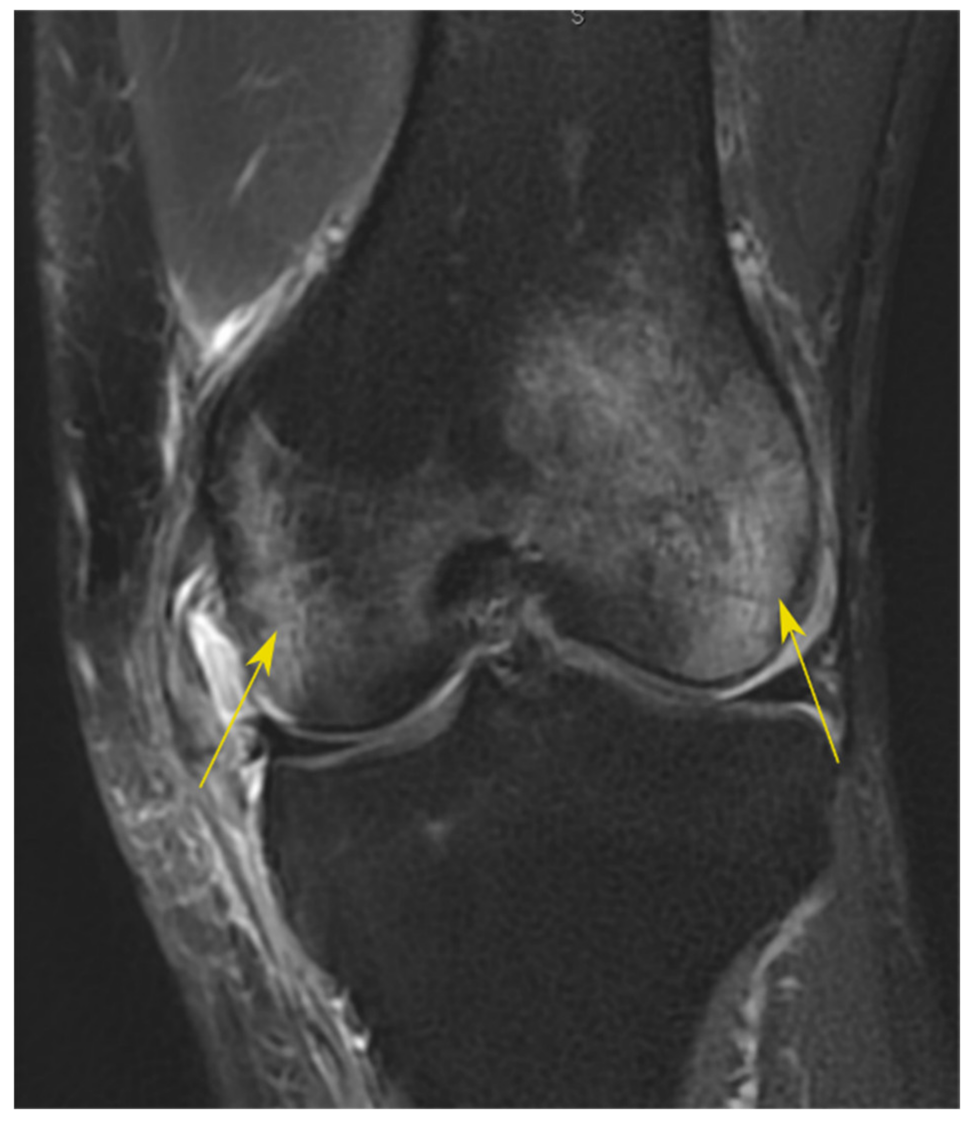 Applsci 11 02482 g001