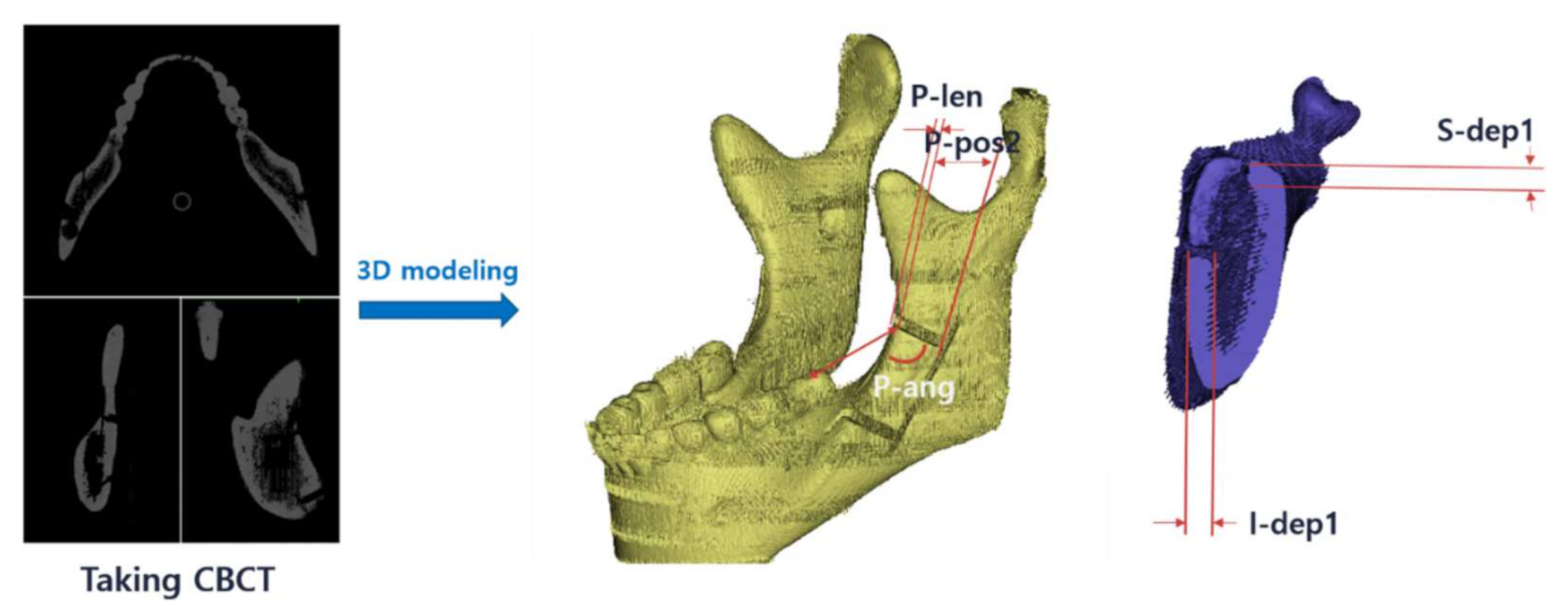 Applsci 11 02885 g005