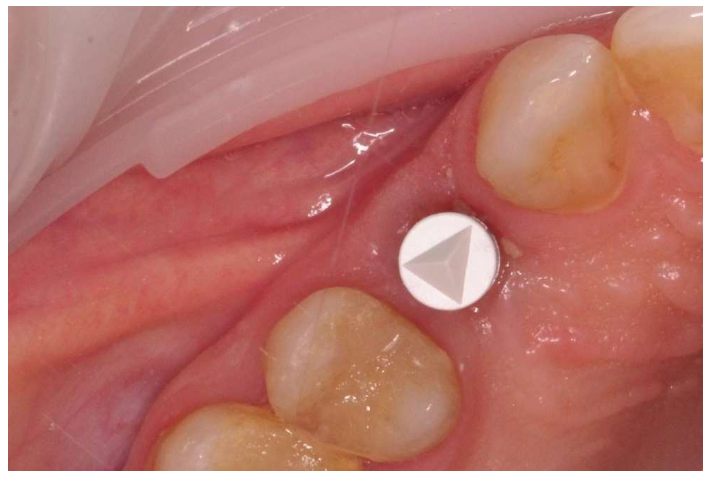 Applsci 11 02958 g002