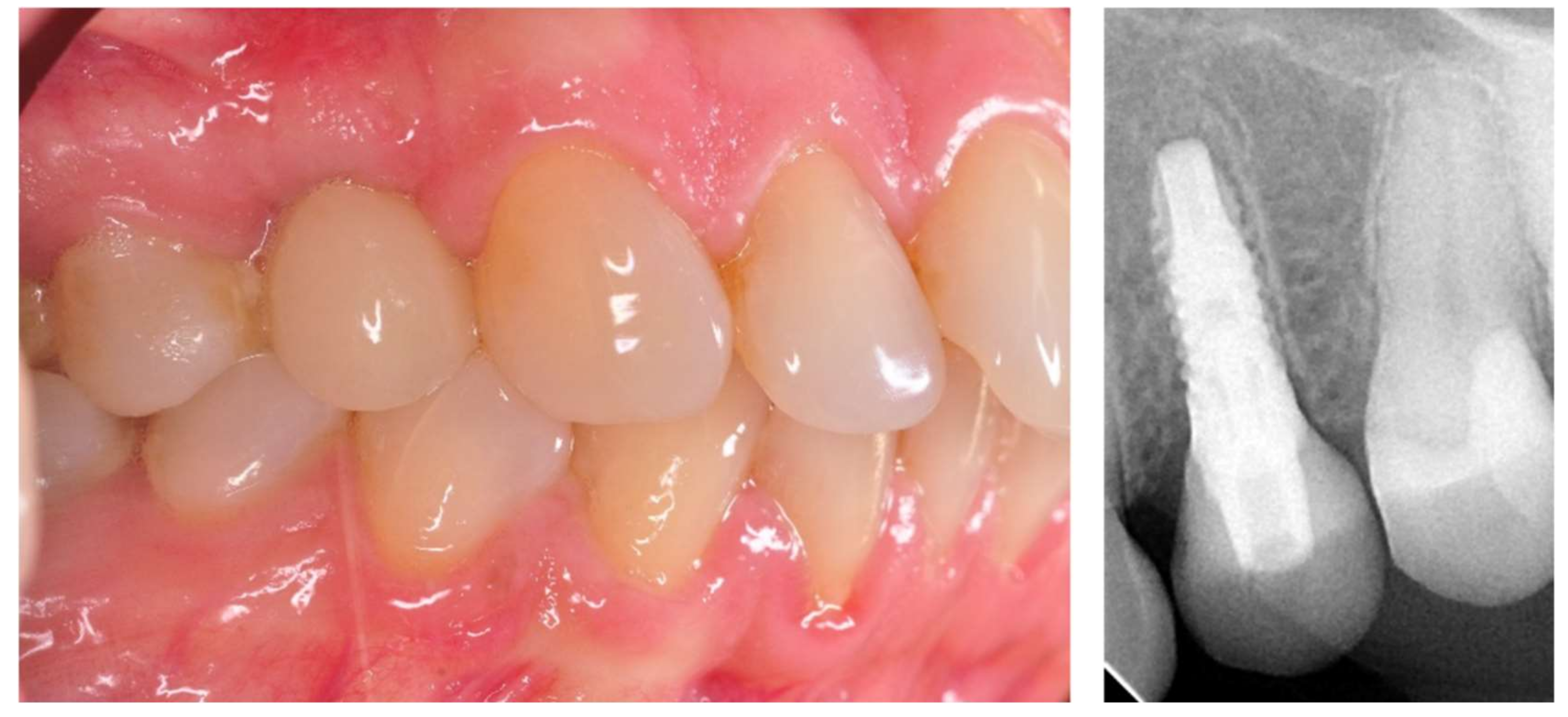 Applsci 11 02958 g003