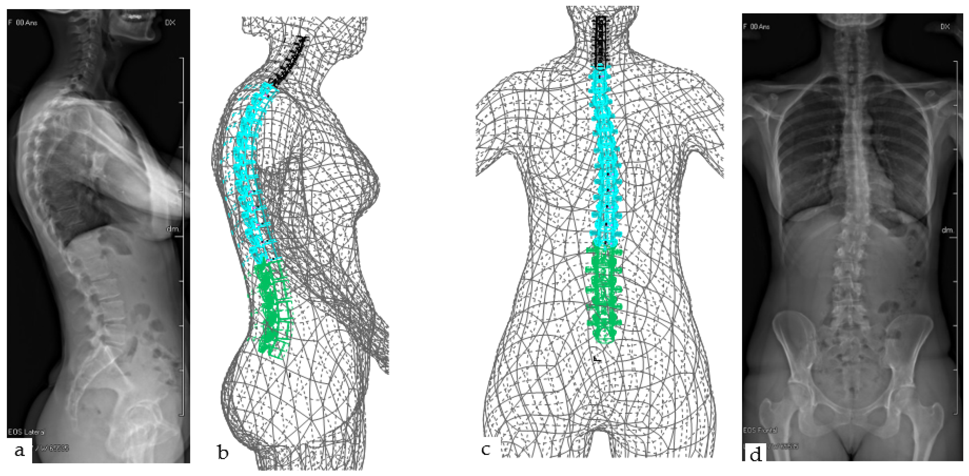 Applsci 11 03171 g012