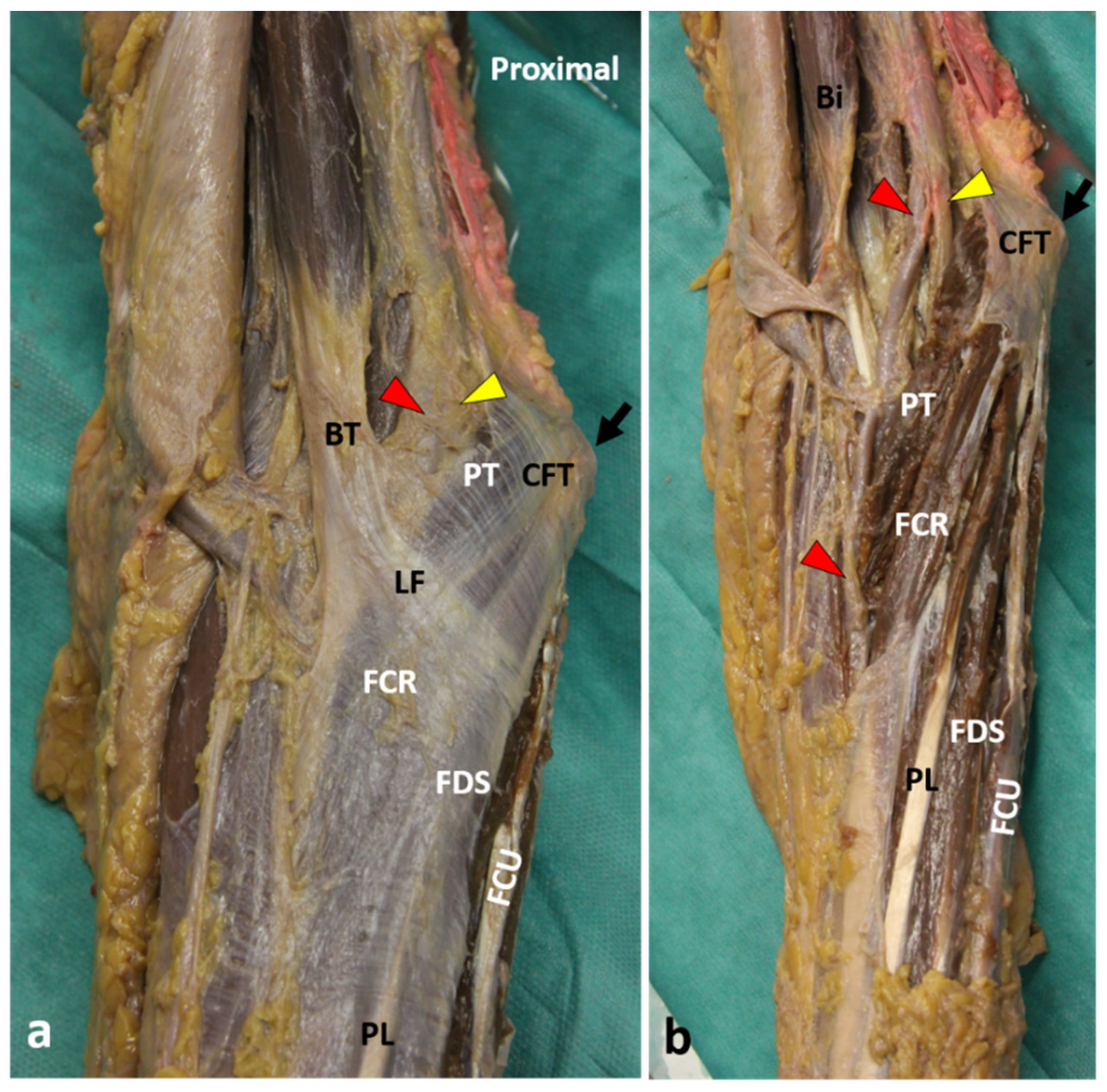 Applsci 11 03431 g005 Applsci 11 03431 g005