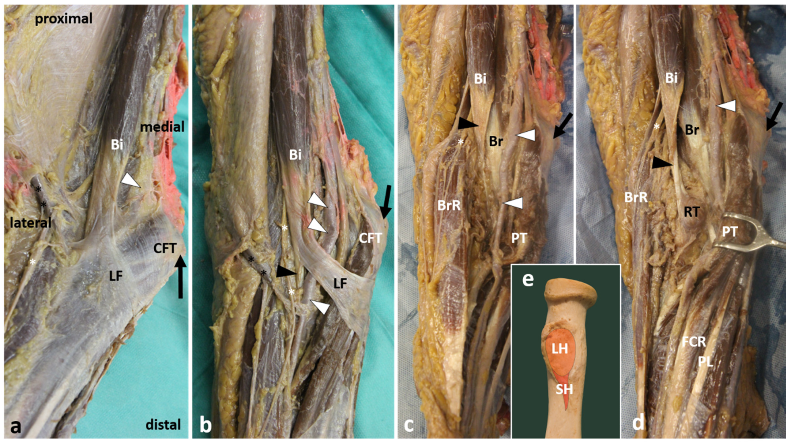 Applsci 11 03431 g008 Applsci 11 03431 g008
