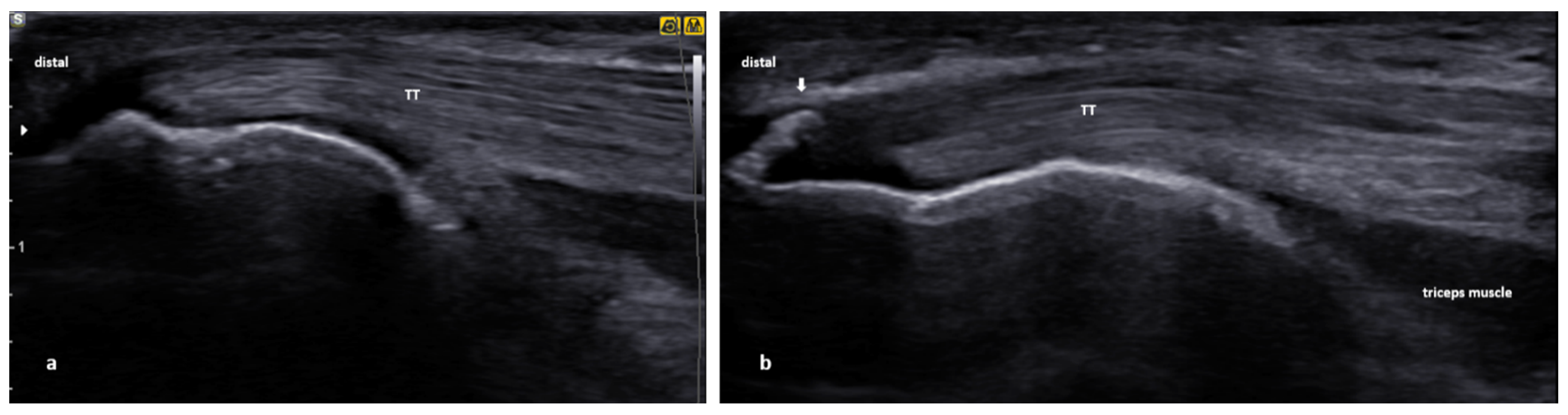 Applsci 11 03431 g012 Applsci 11 03431 g012