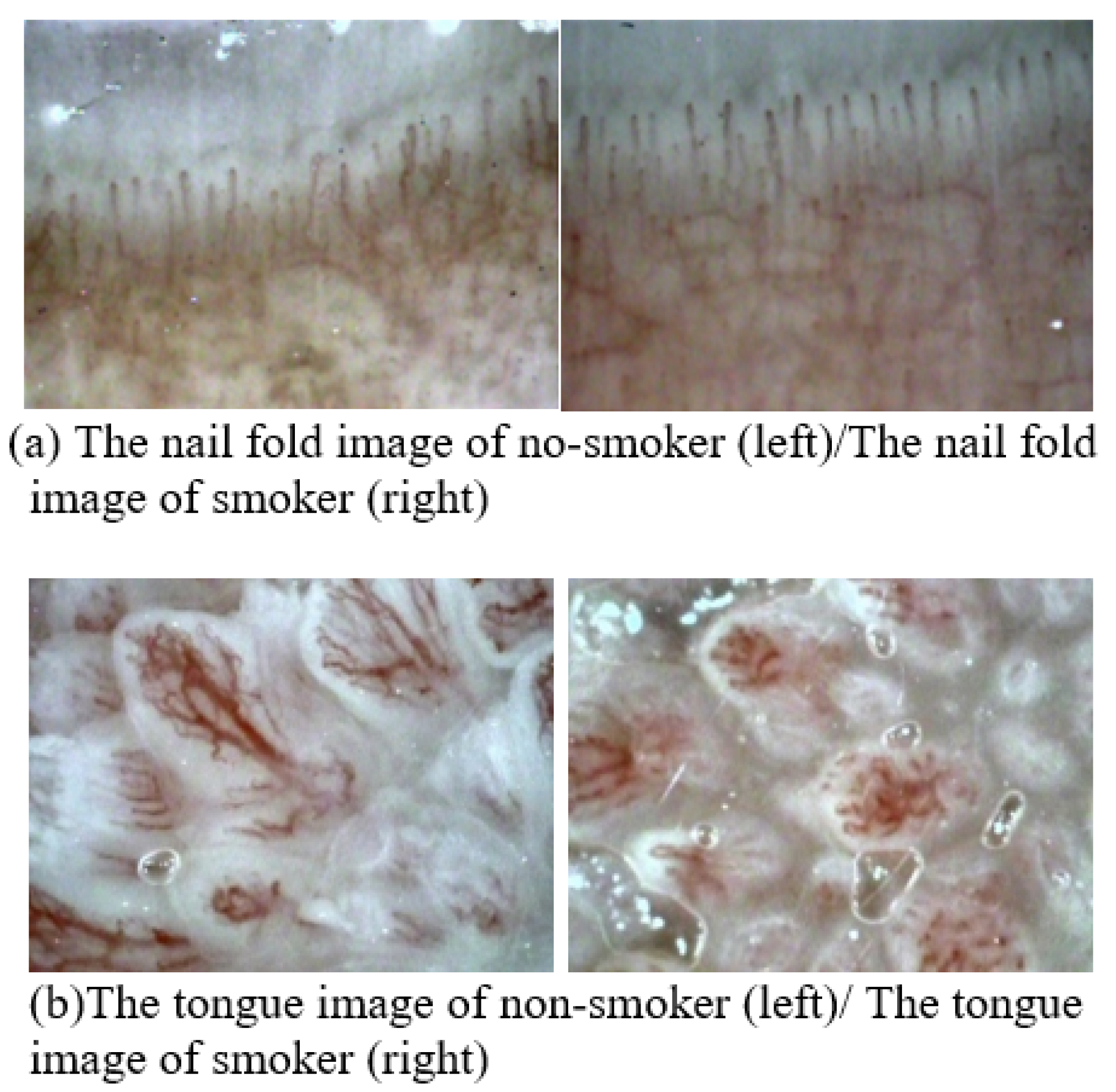 Applsci 11 03460 g003 Applsci 11 03460 g003