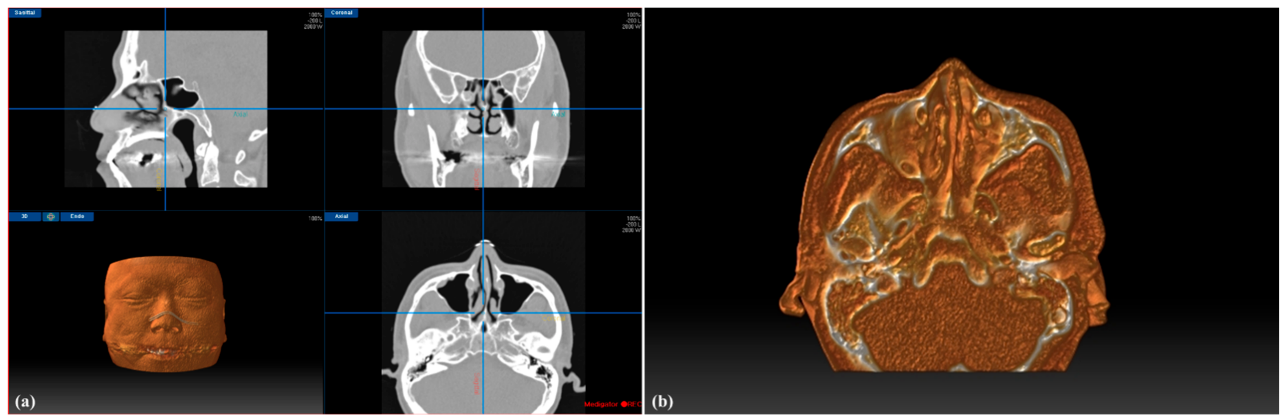 Applsci 11 03675 g002