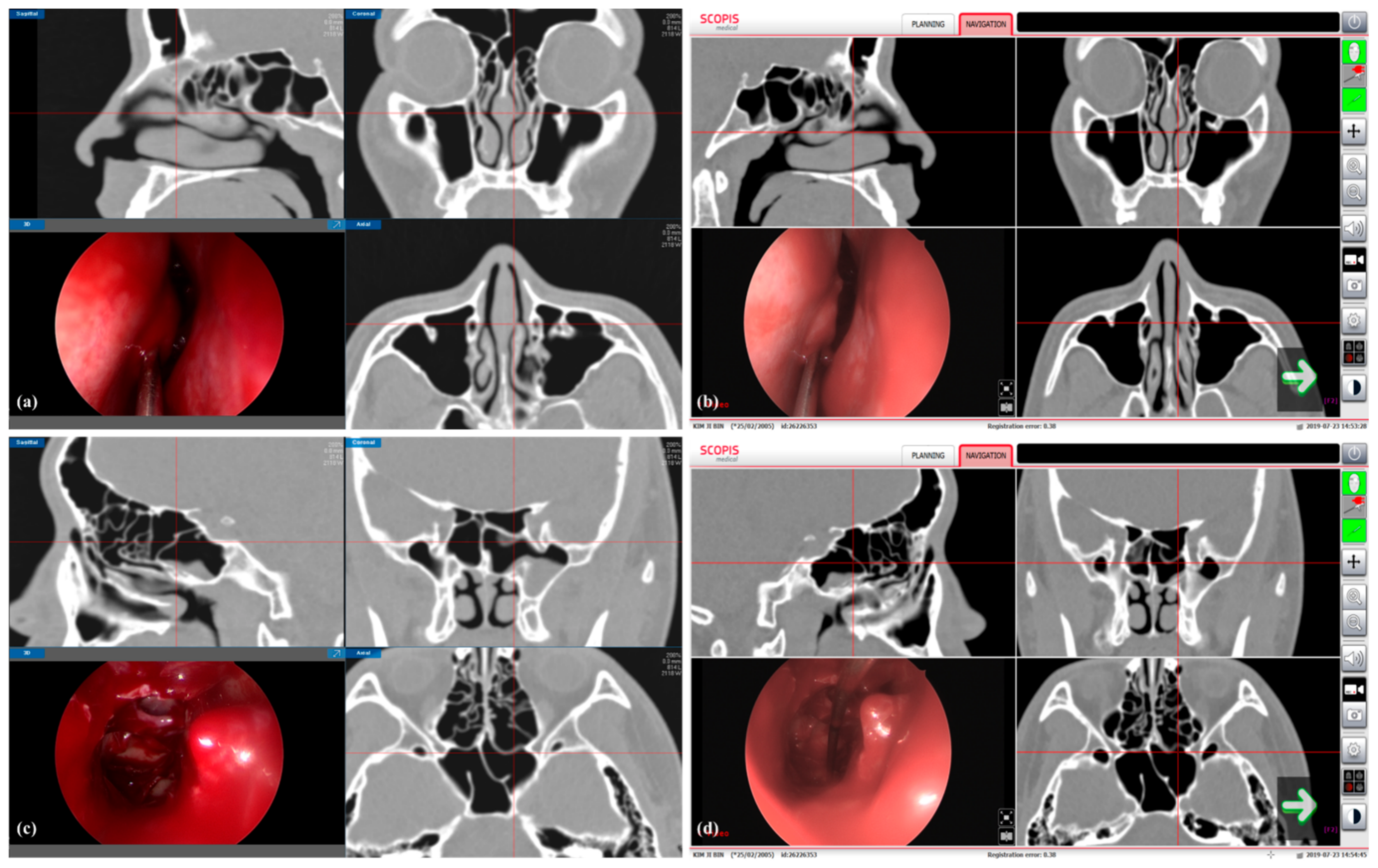 Applsci 11 03675 g005