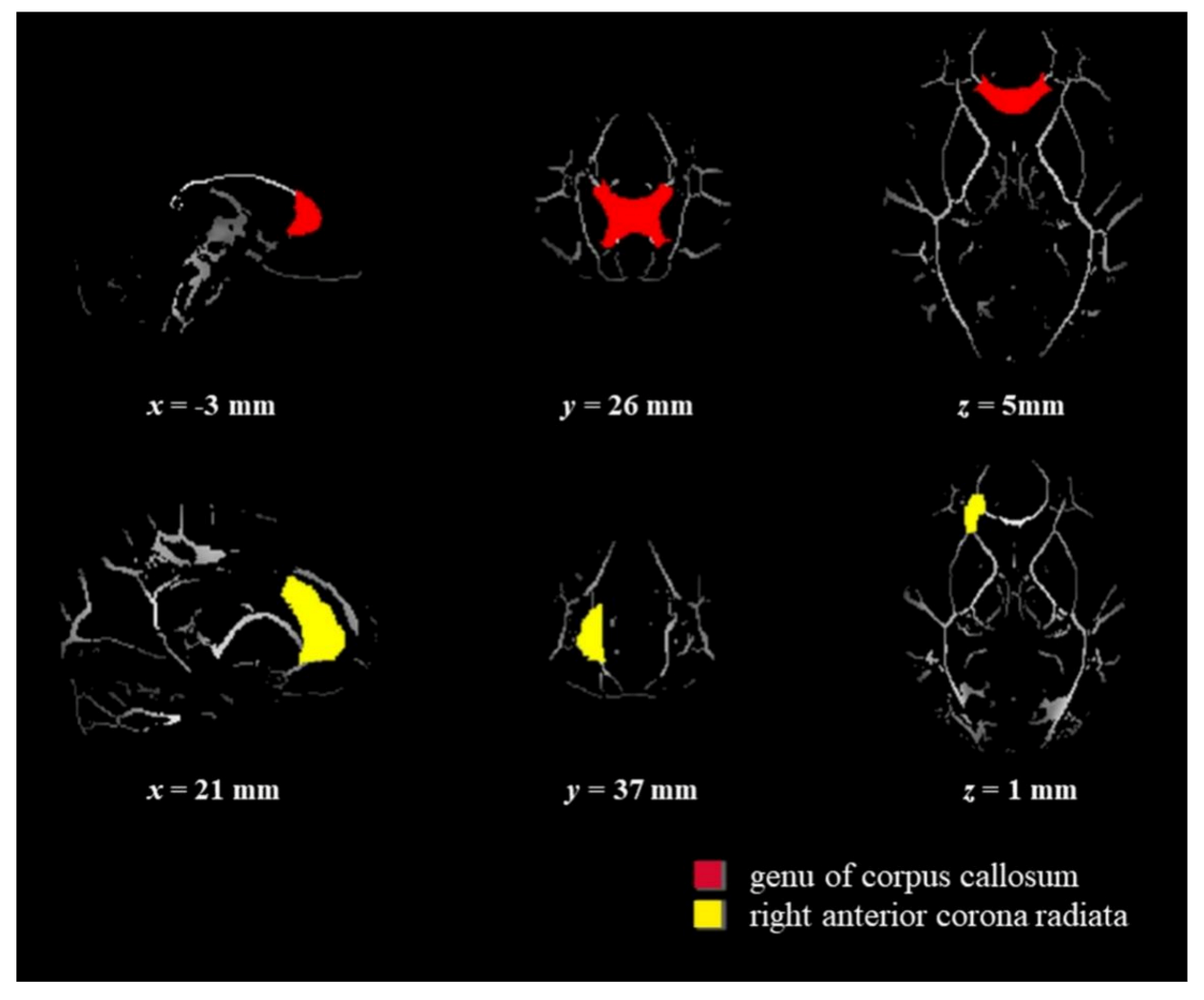 Applsci 11 03843 g001