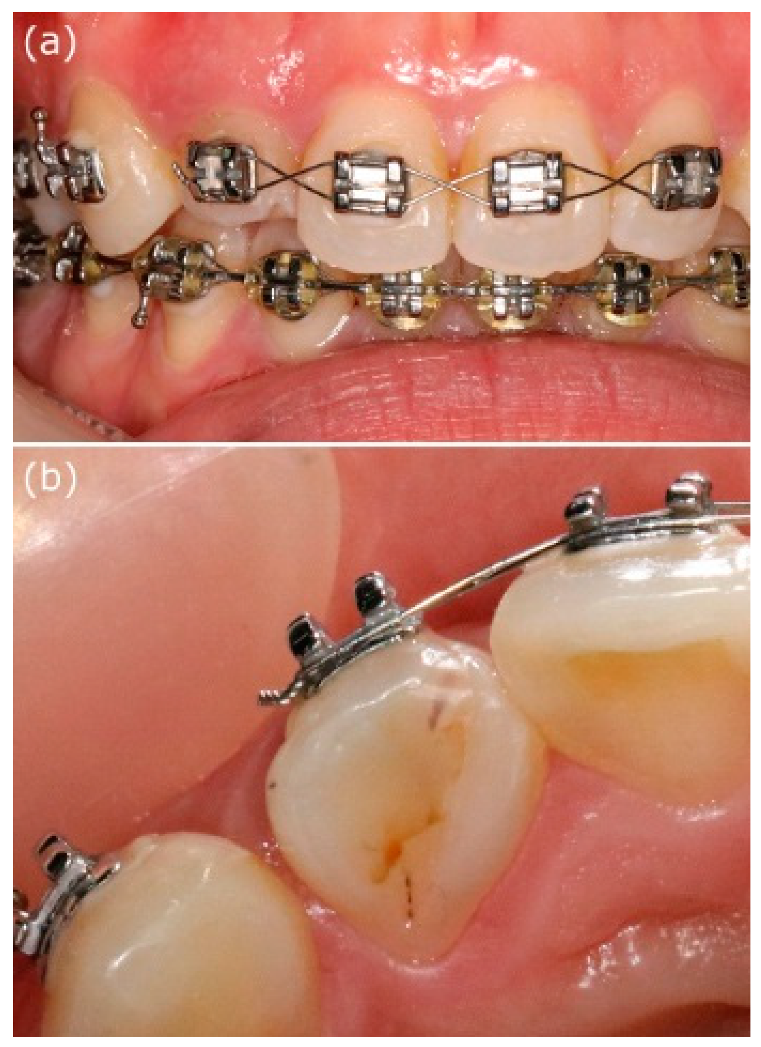 Applsci 11 03848 g001