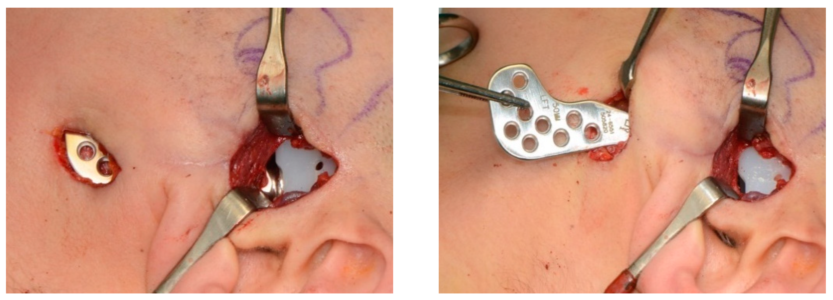 Applsci 11 03935 g001