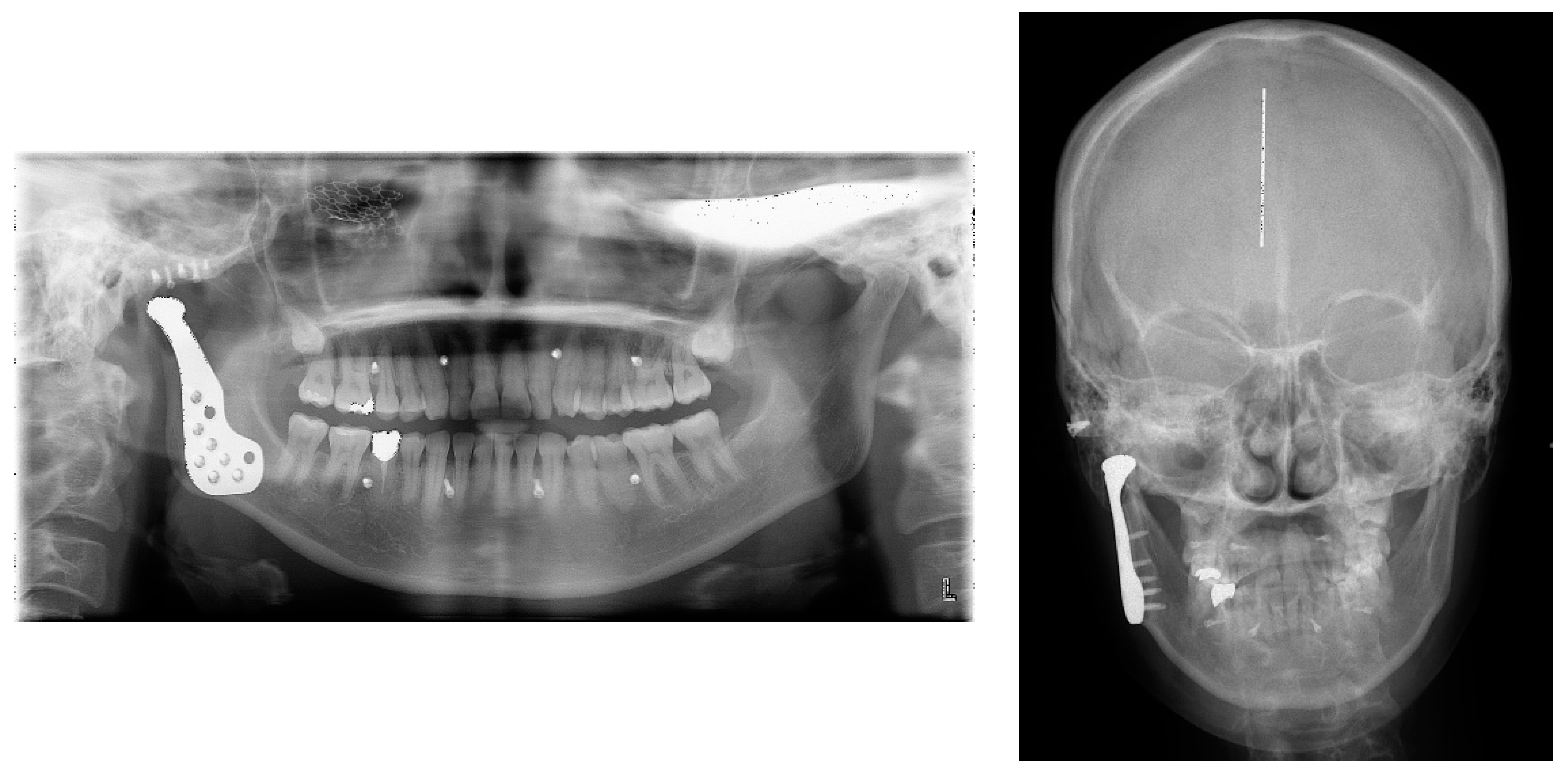 Applsci 11 03935 g002