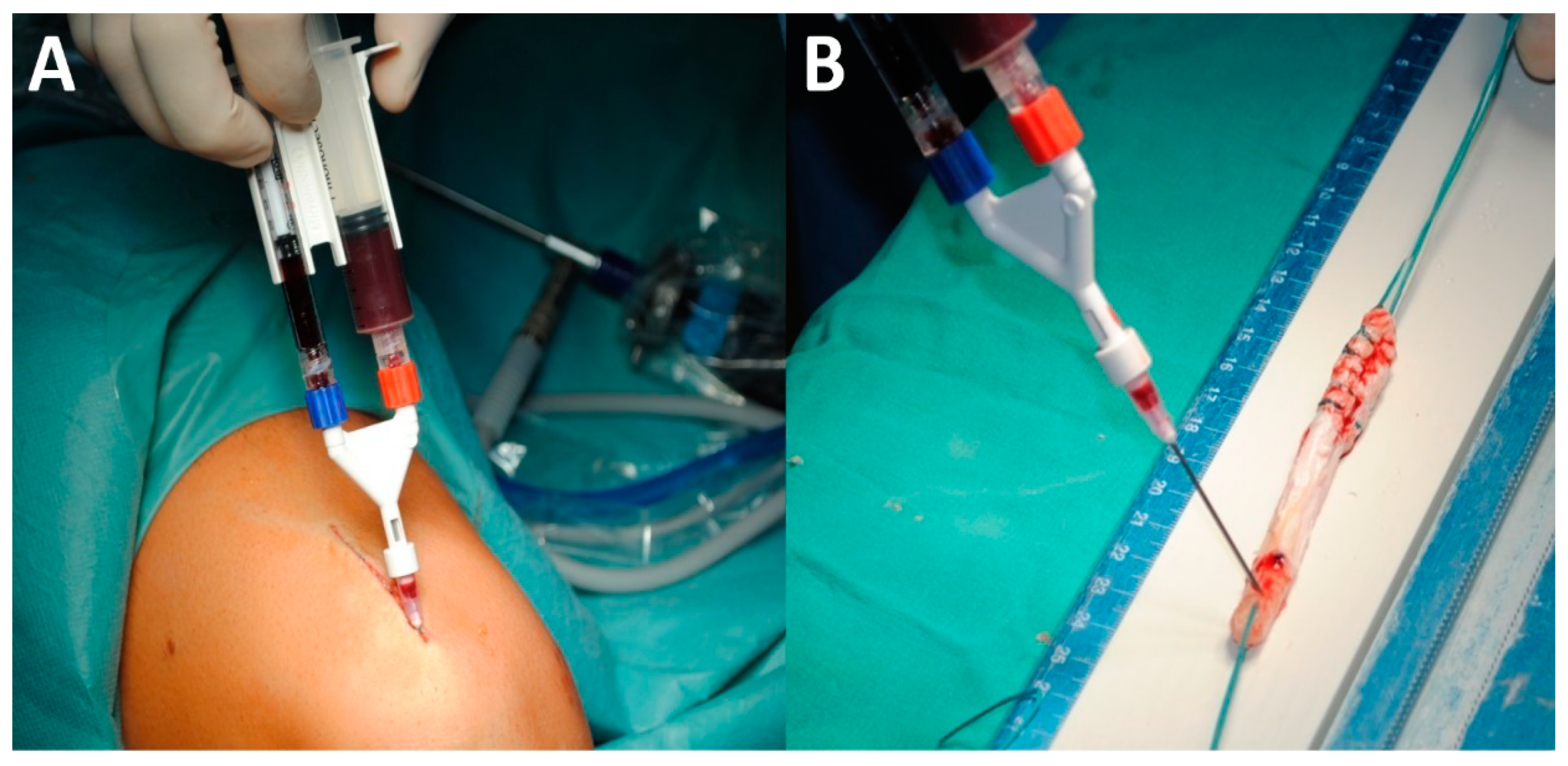 Applsci 11 03993 g002