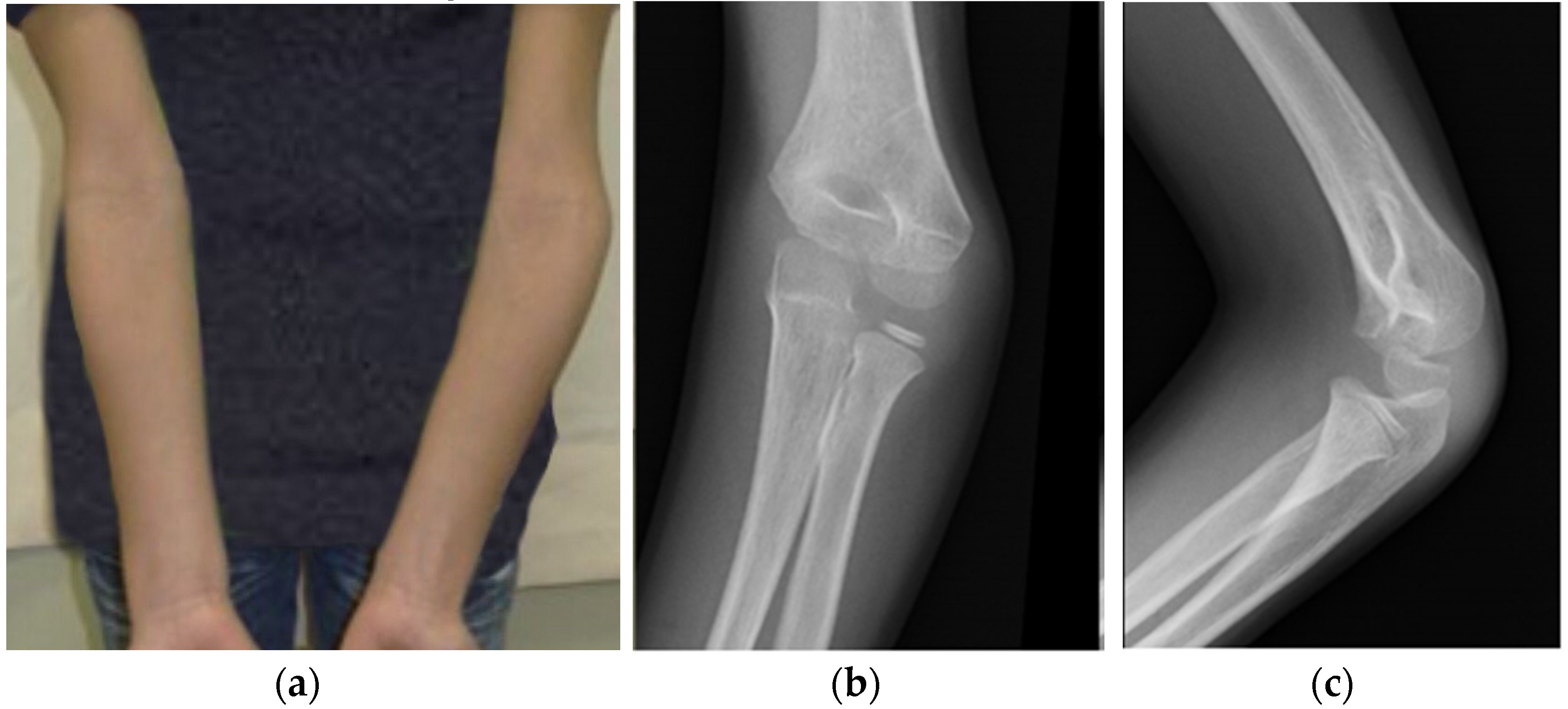 Applsci 11 04057 g002