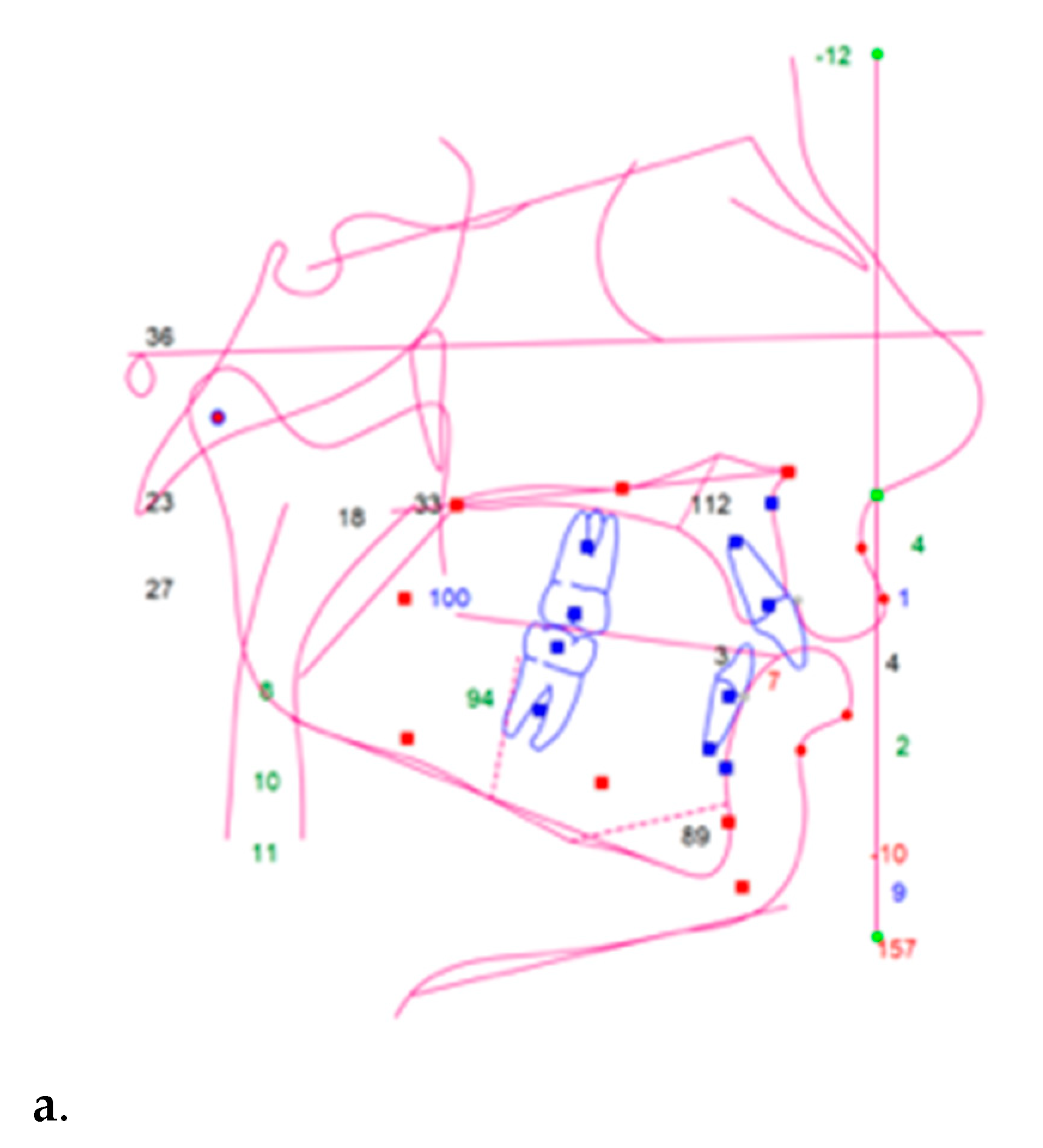 Applsci 11 04118 g001a