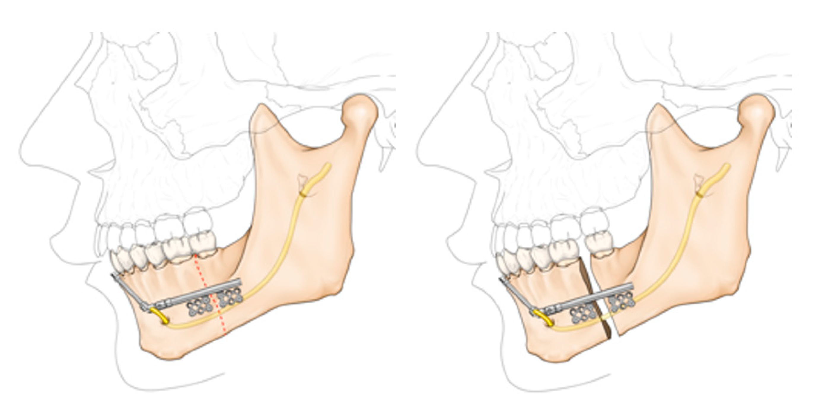 Applsci 11 04118 g002