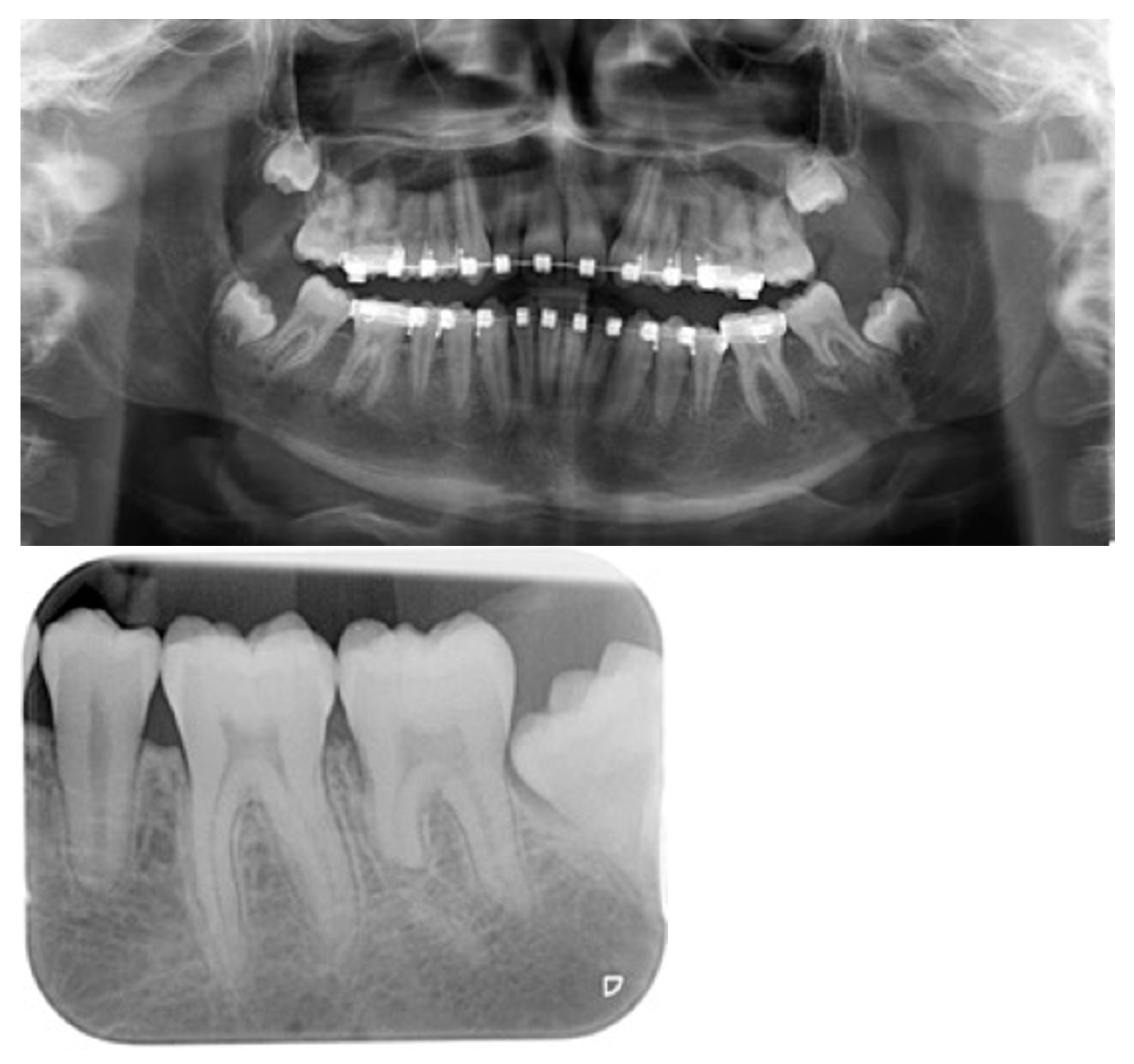 Applsci 11 04118 g006