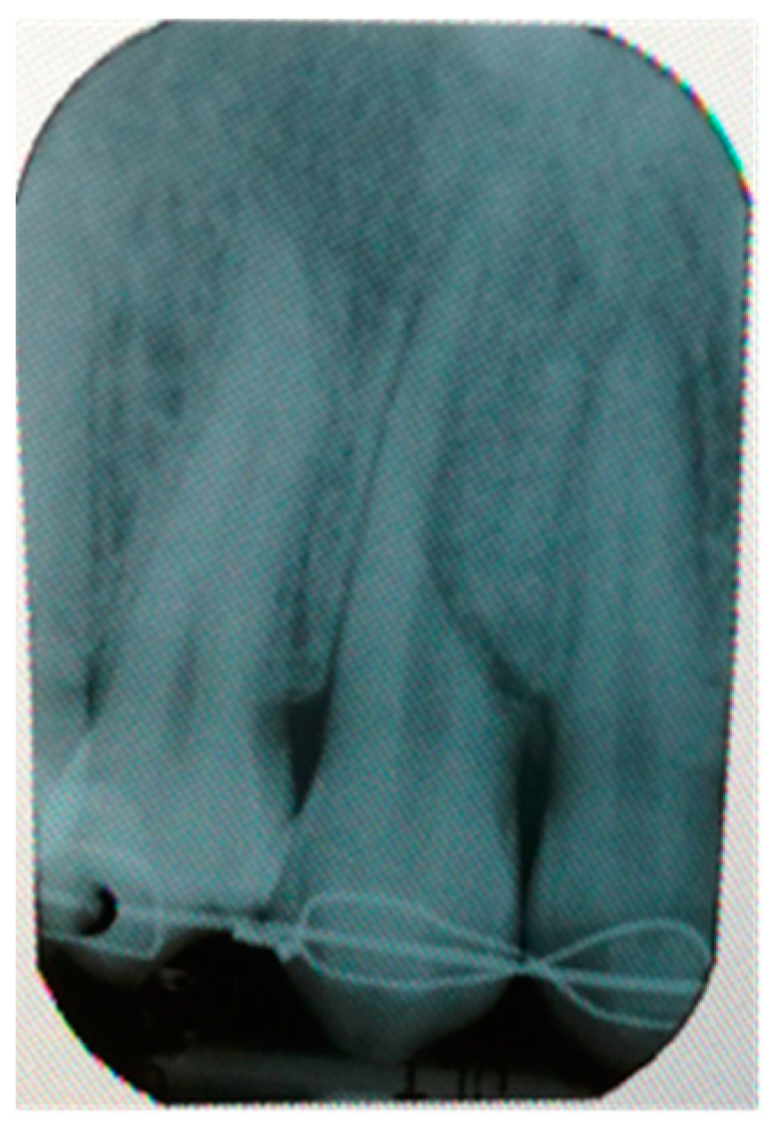 Applsci 11 04271 g002