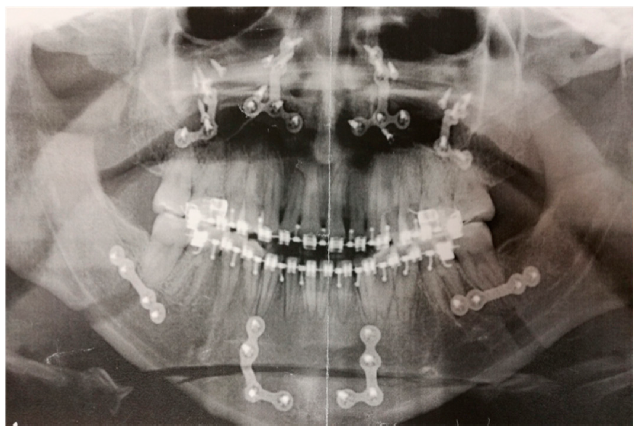 Applsci 11 04271 g004