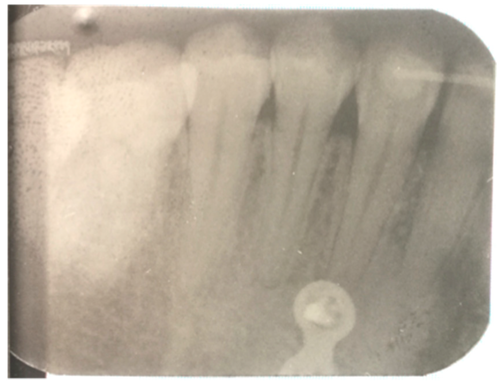 Applsci 11 04271 g005