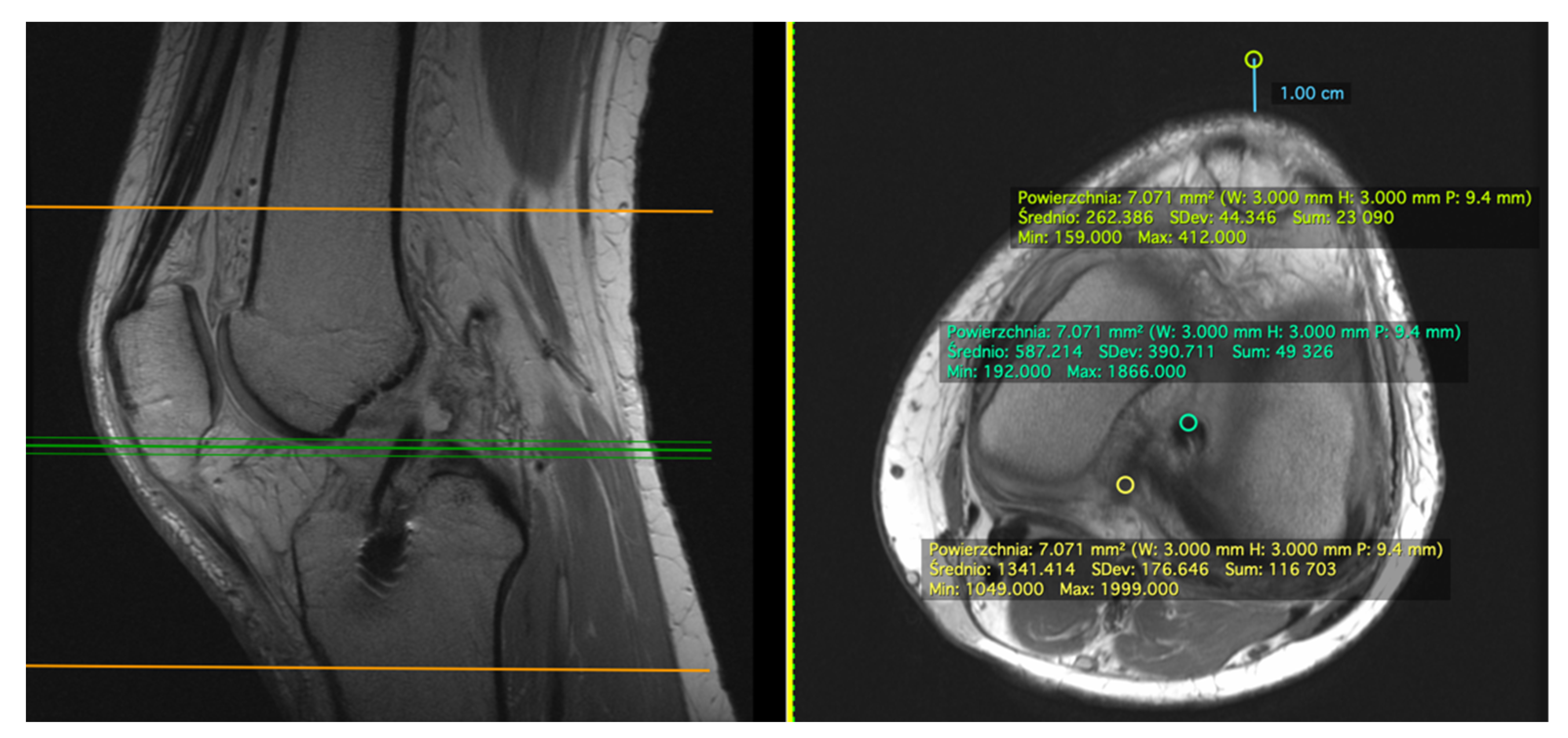 Applsci 11 05278 g002