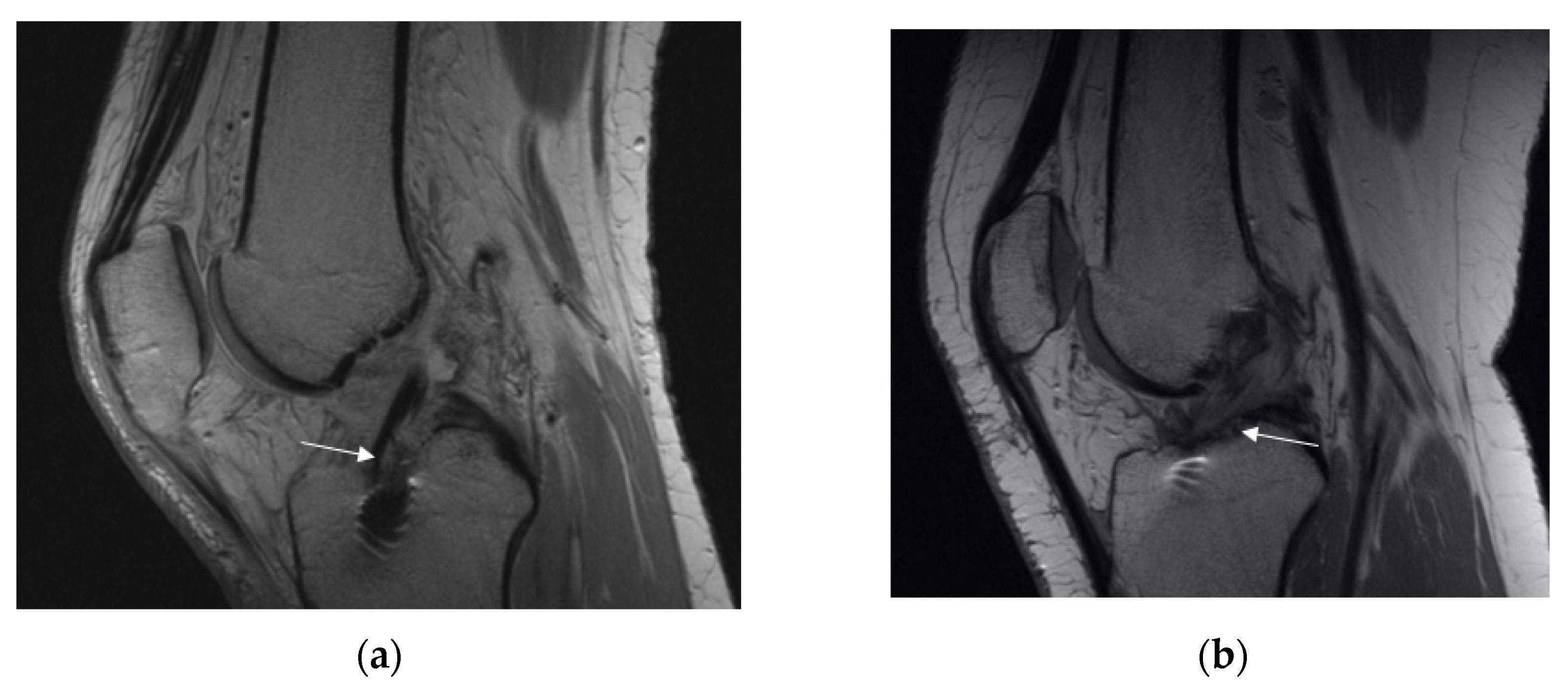 Applsci 11 05278 g003