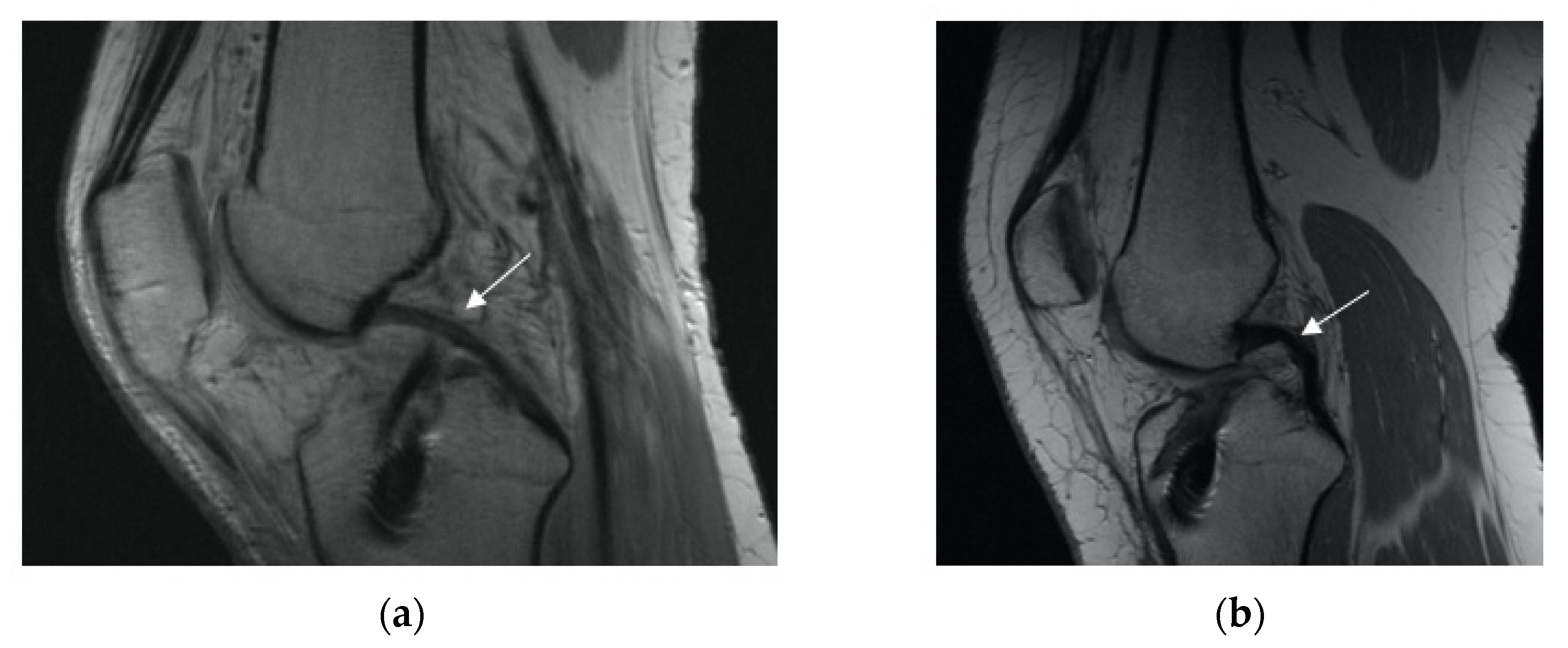 Applsci 11 05278 g004