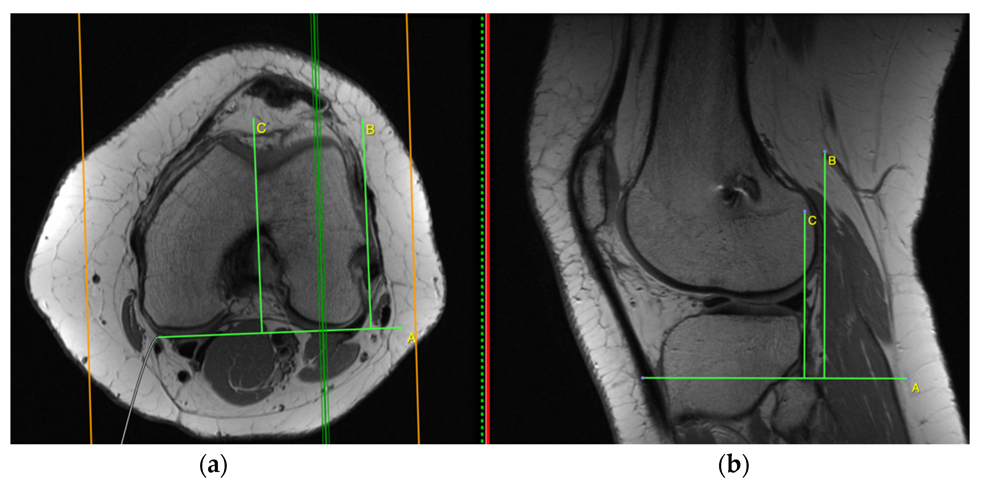 Applsci 11 05278 g005