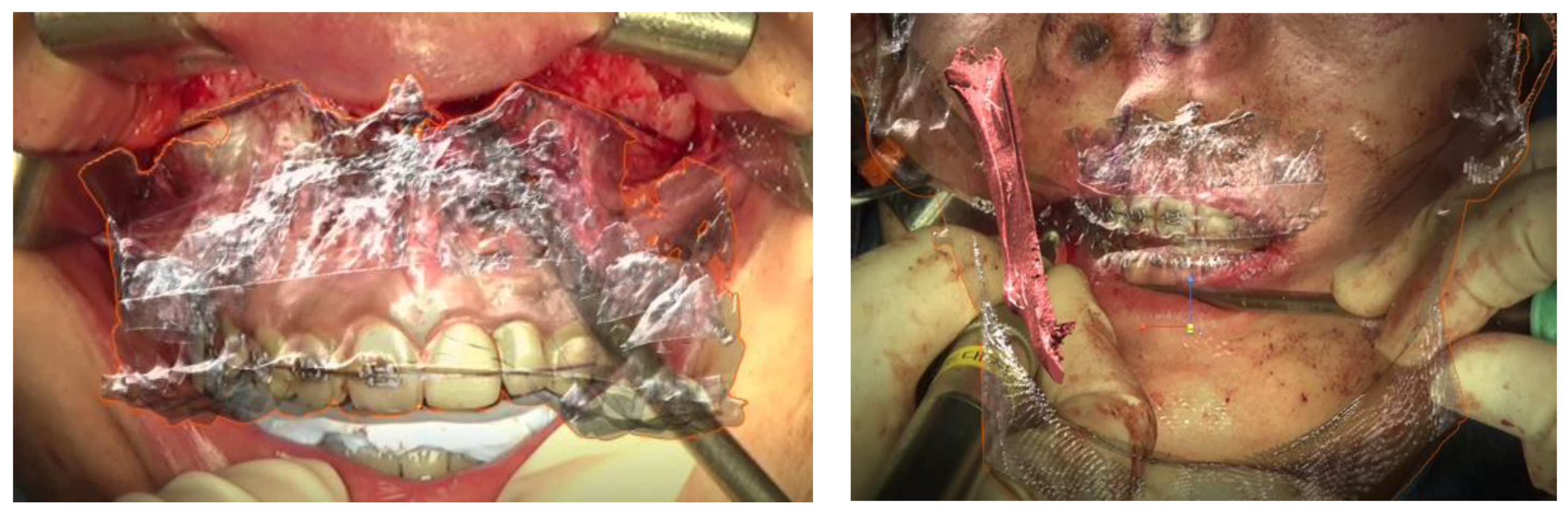 Applsci 11 05673 g005