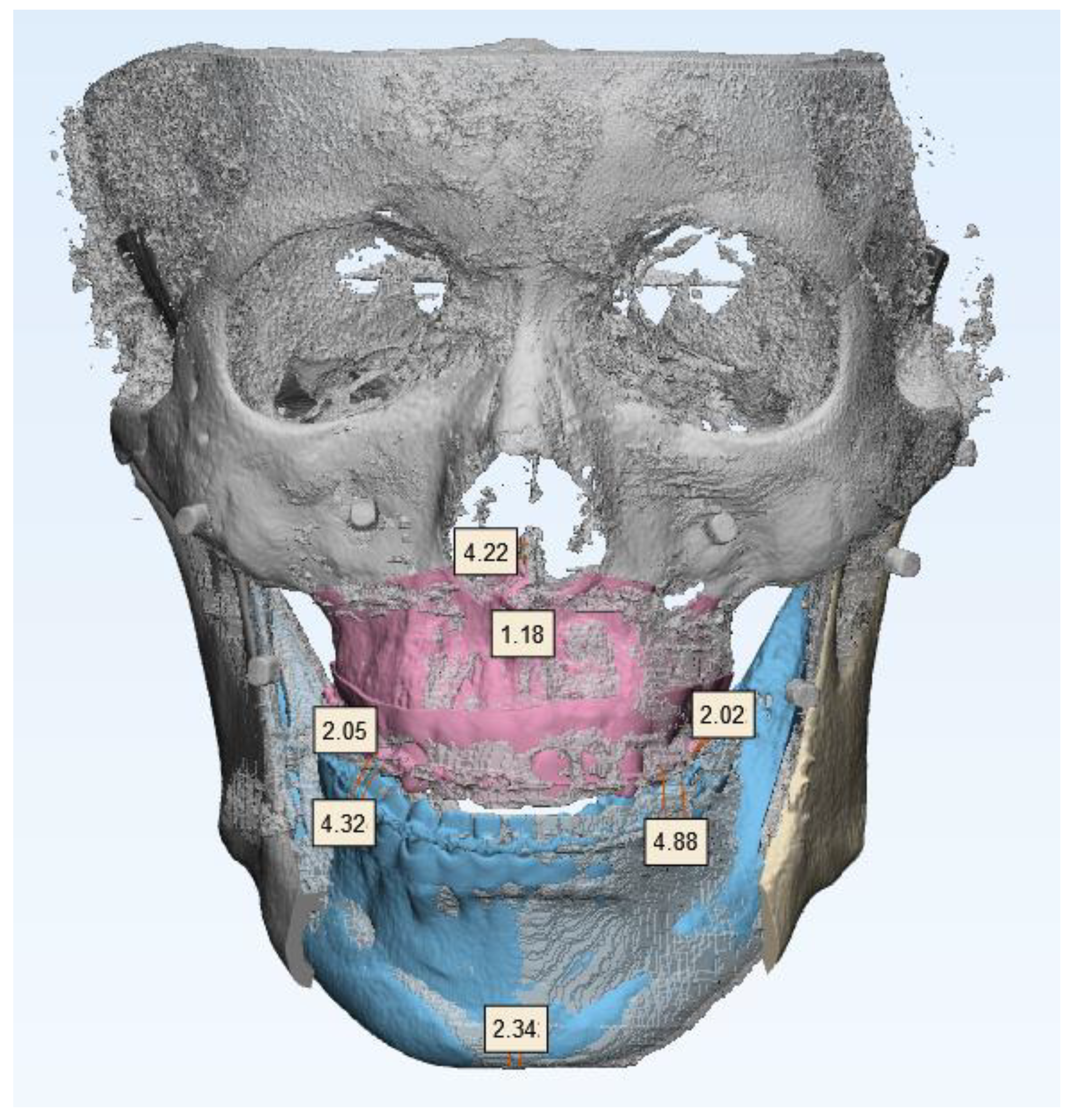 Applsci 11 05673 g006