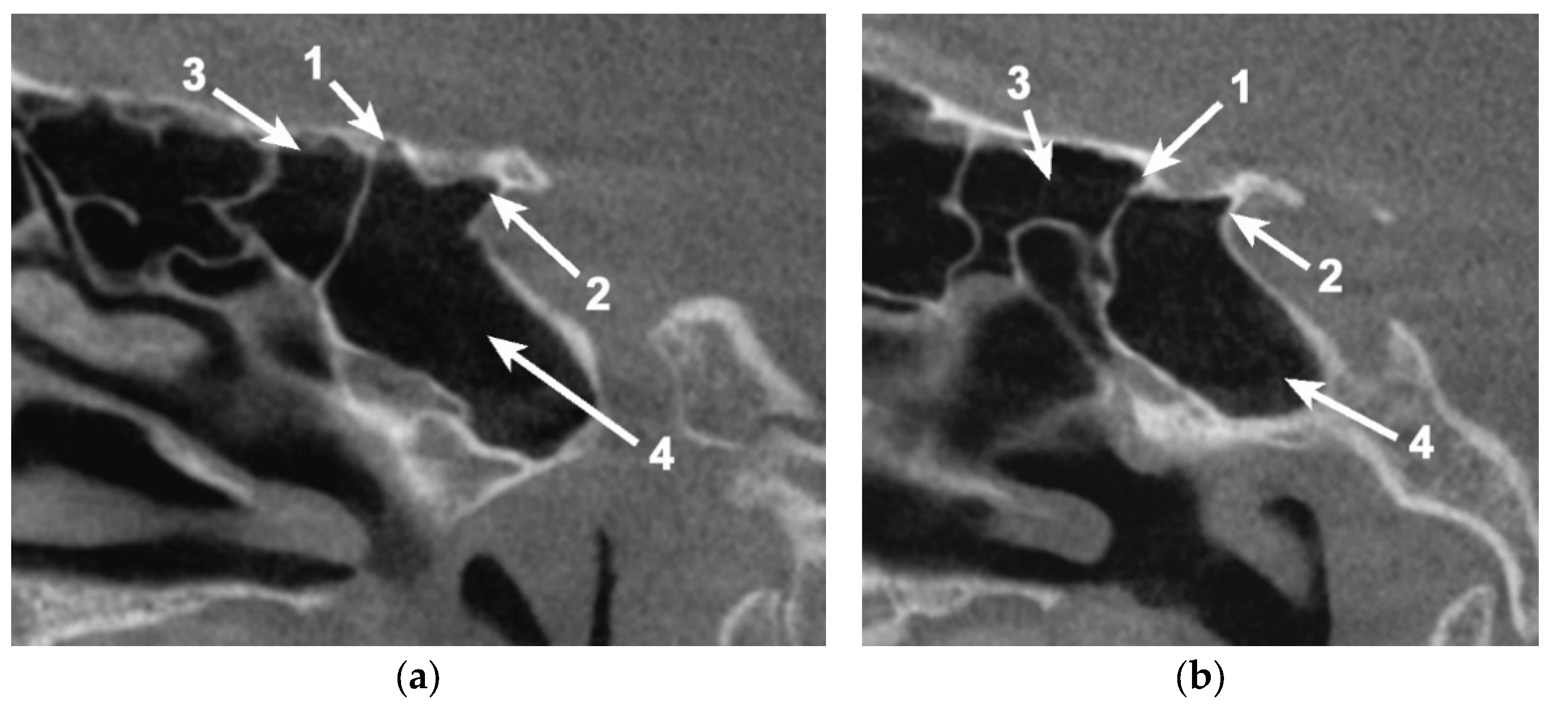 Applsci 11 05797 g003