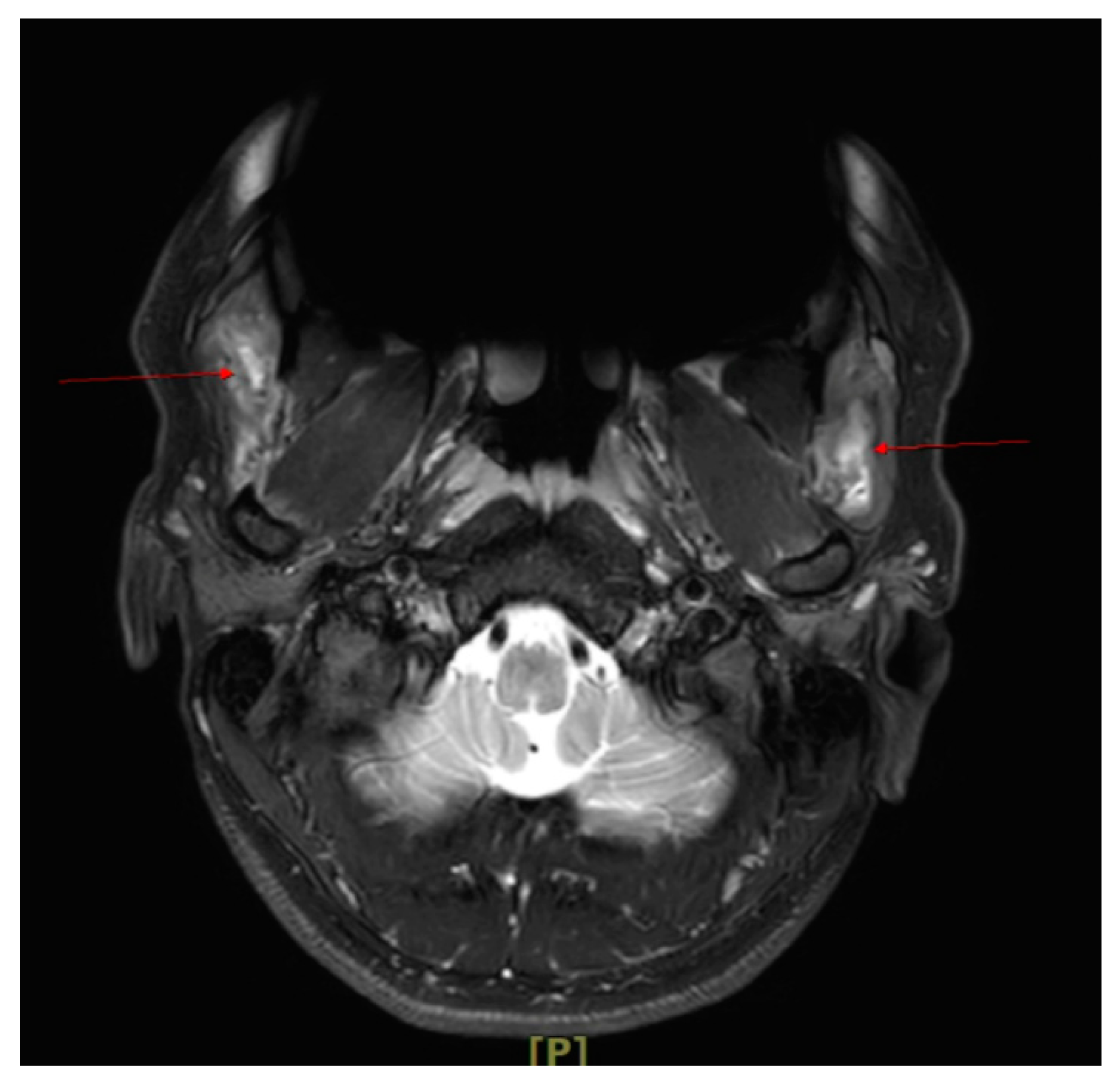 Applsci 11 05824 g003