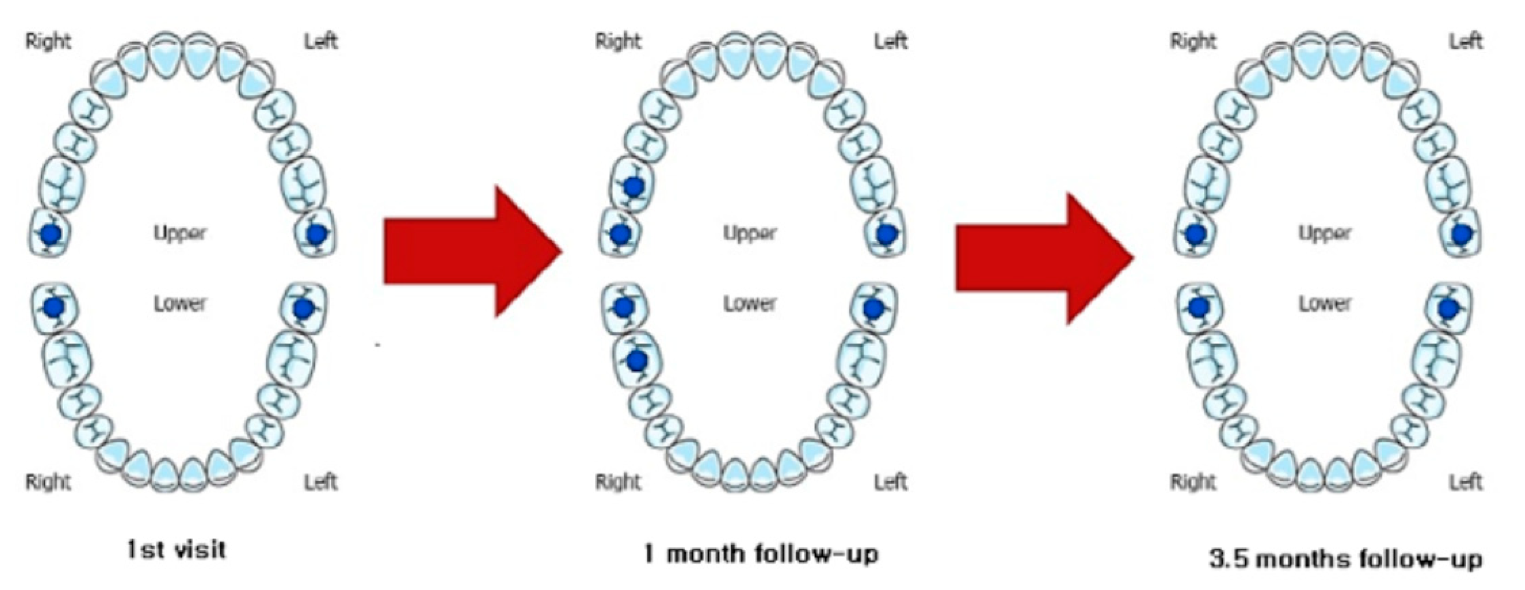 Applsci 11 05824 g006